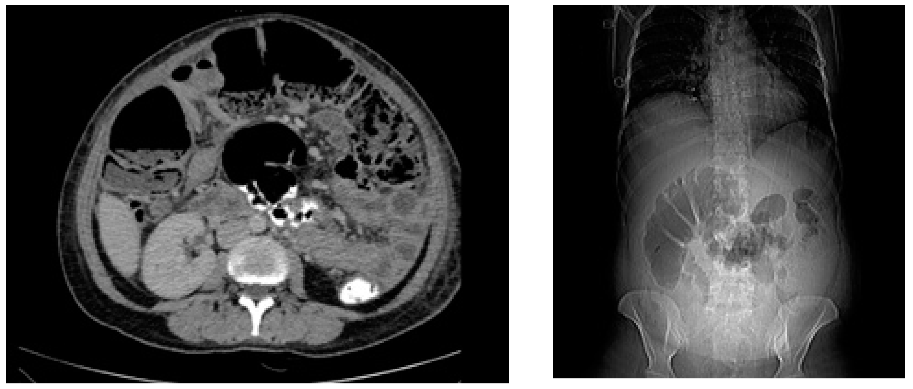 Pathogens 14 00181 g002