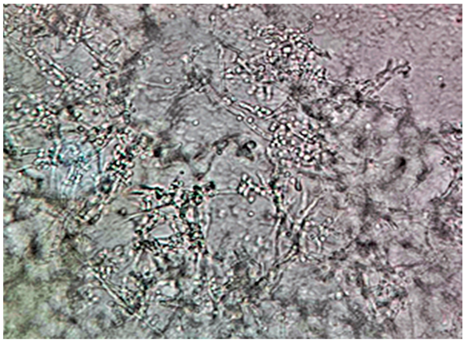Pathogens 14 00327 g005 Pathogens 14 00327 g005