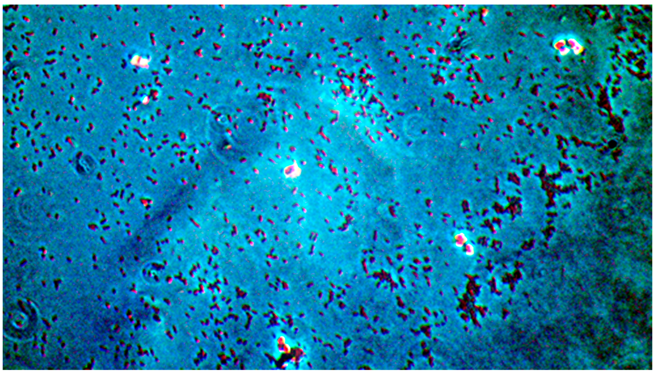 Pathogens 14 00327 g006 Pathogens 14 00327 g006