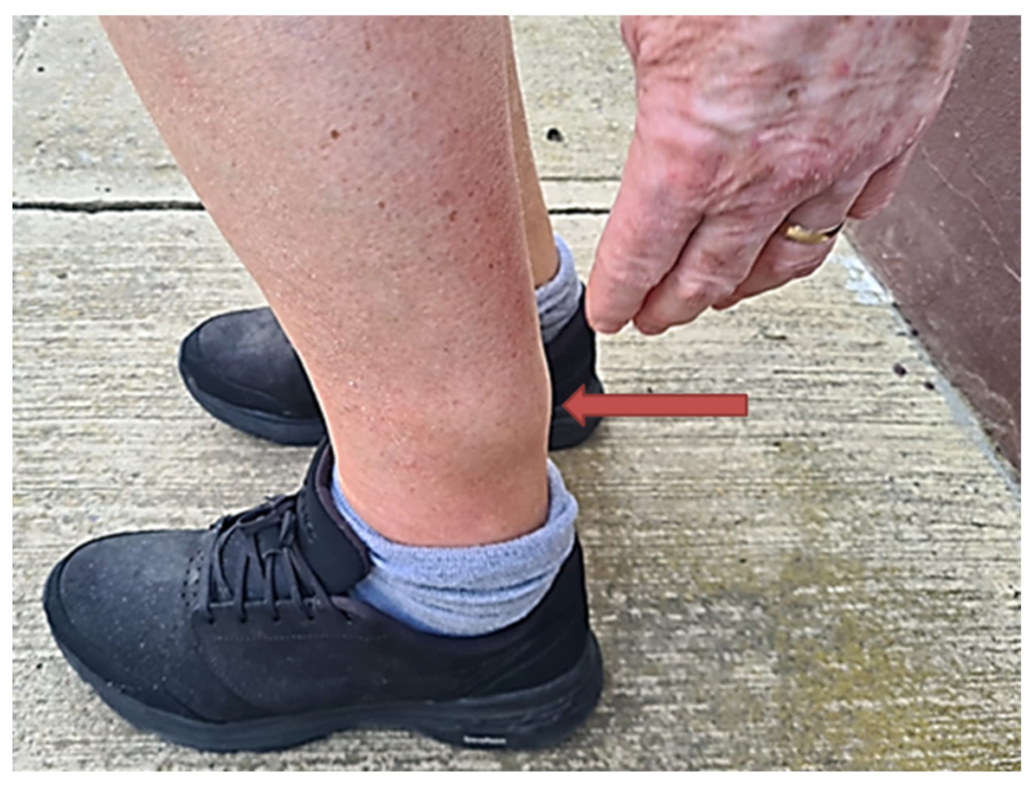 Pathogens 14 00343 g001