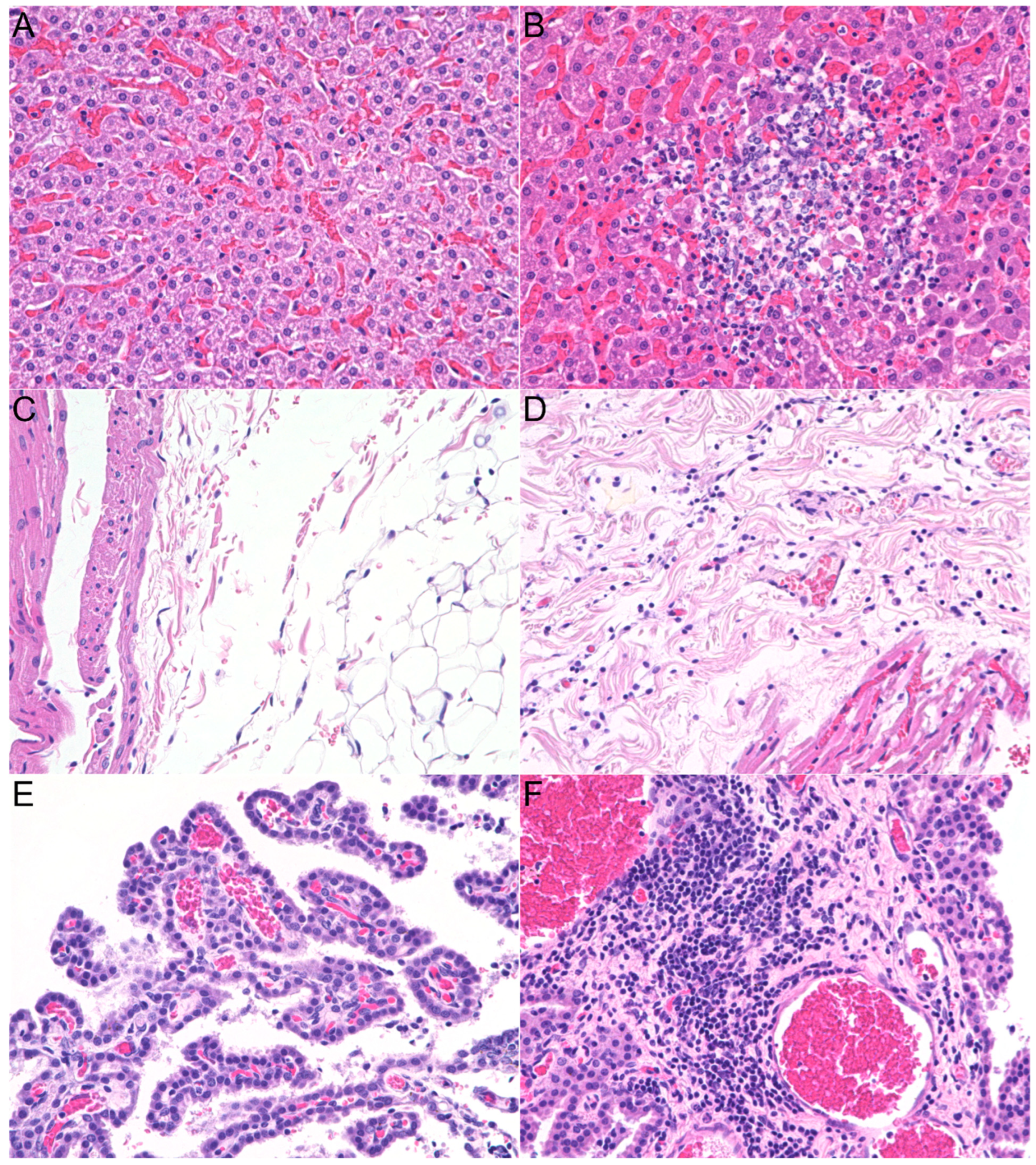 Pathogens 14 00421 g005 Pathogens 14 00421 g005