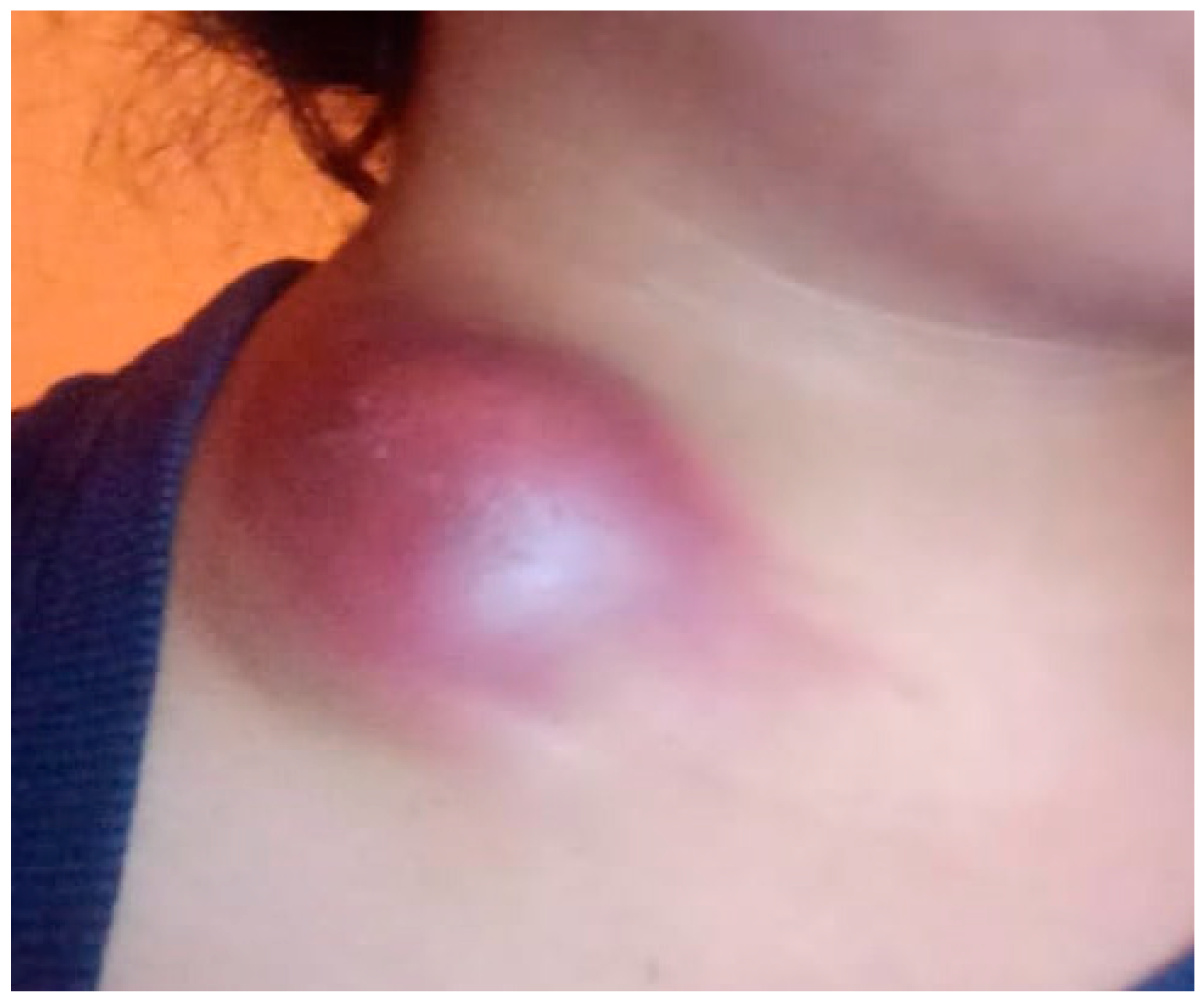 Pathogens 14 00488 g001