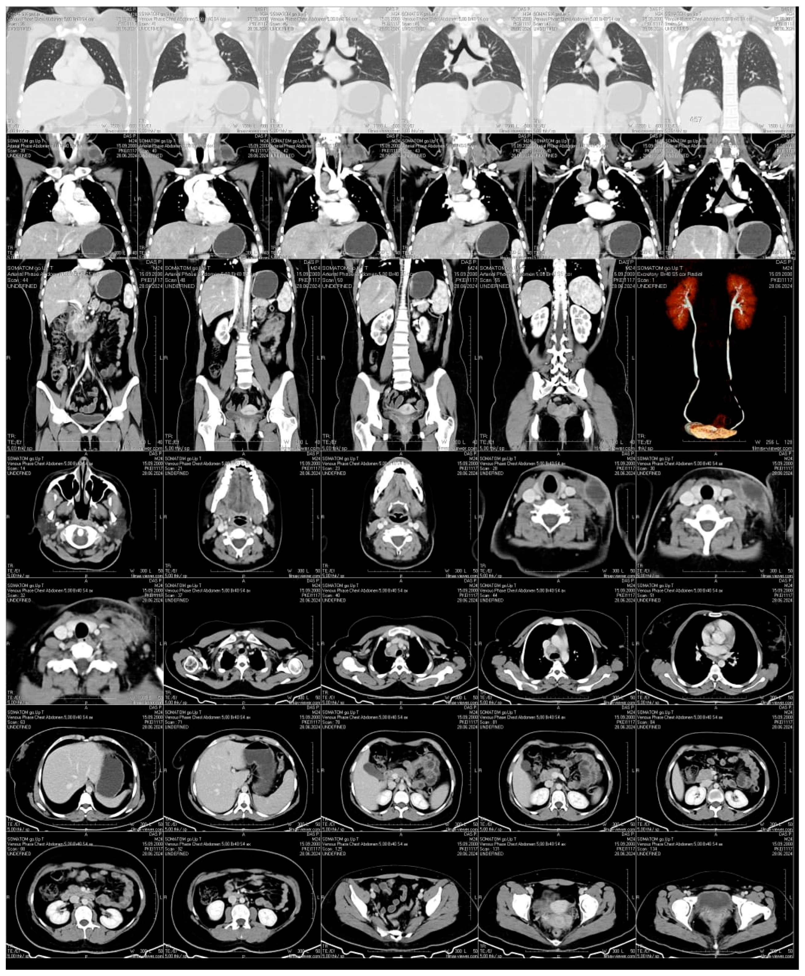 Pathogens 14 00488 g003