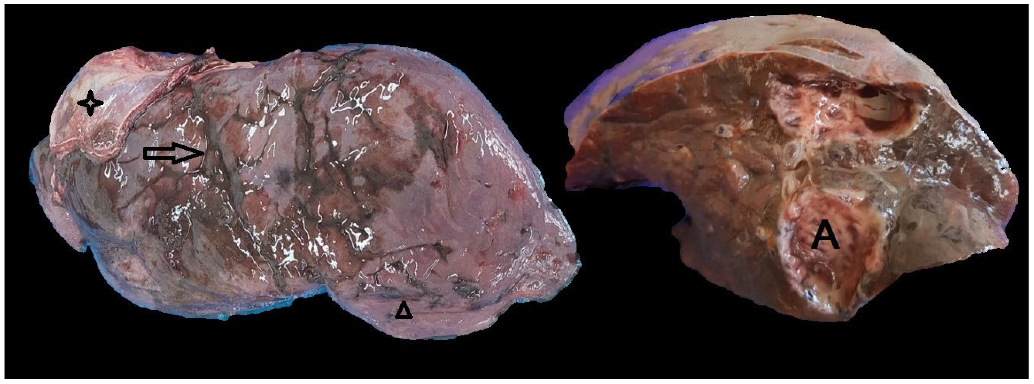 Pathogens 14 00516 g003