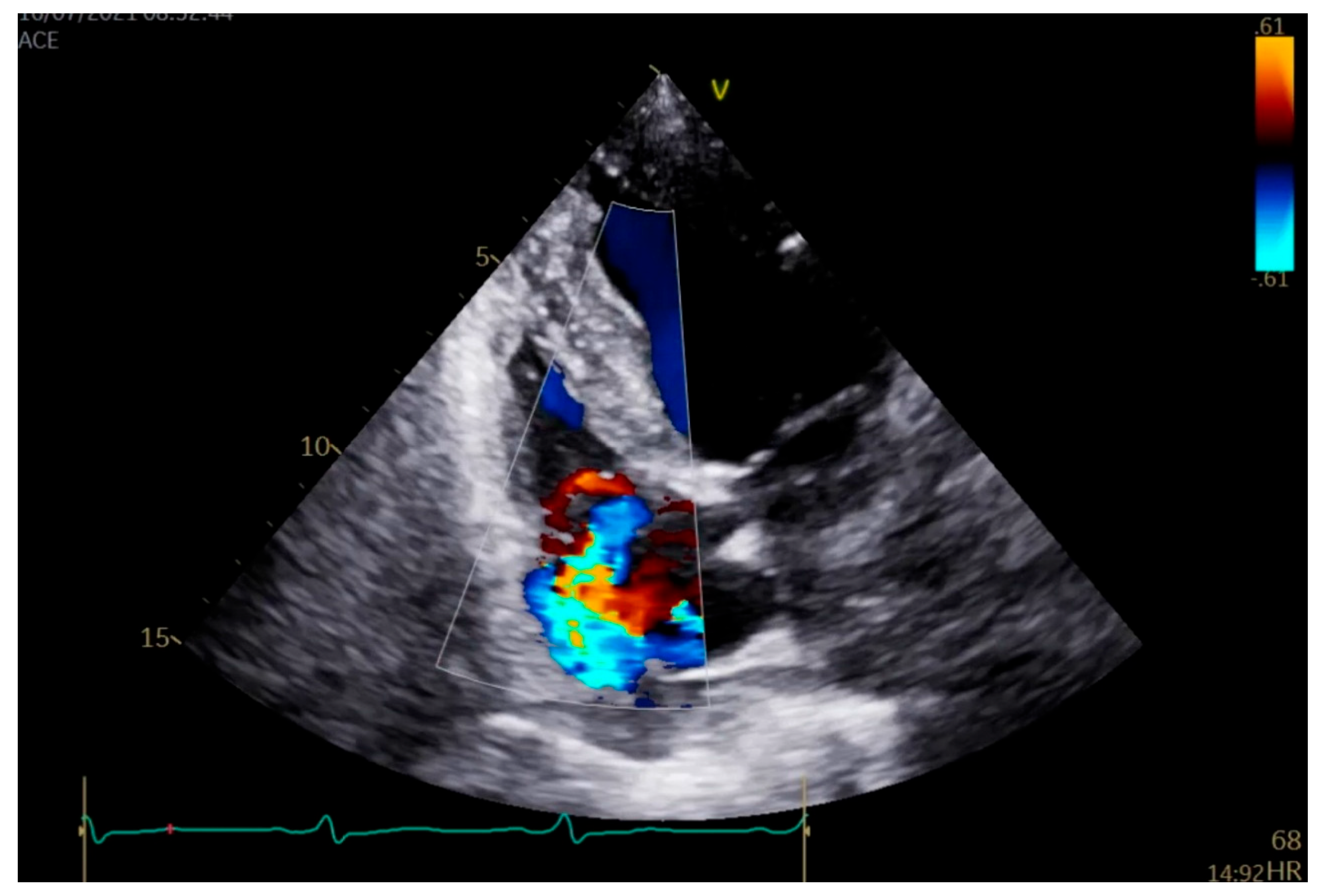 Pathogens 14 00539 g001