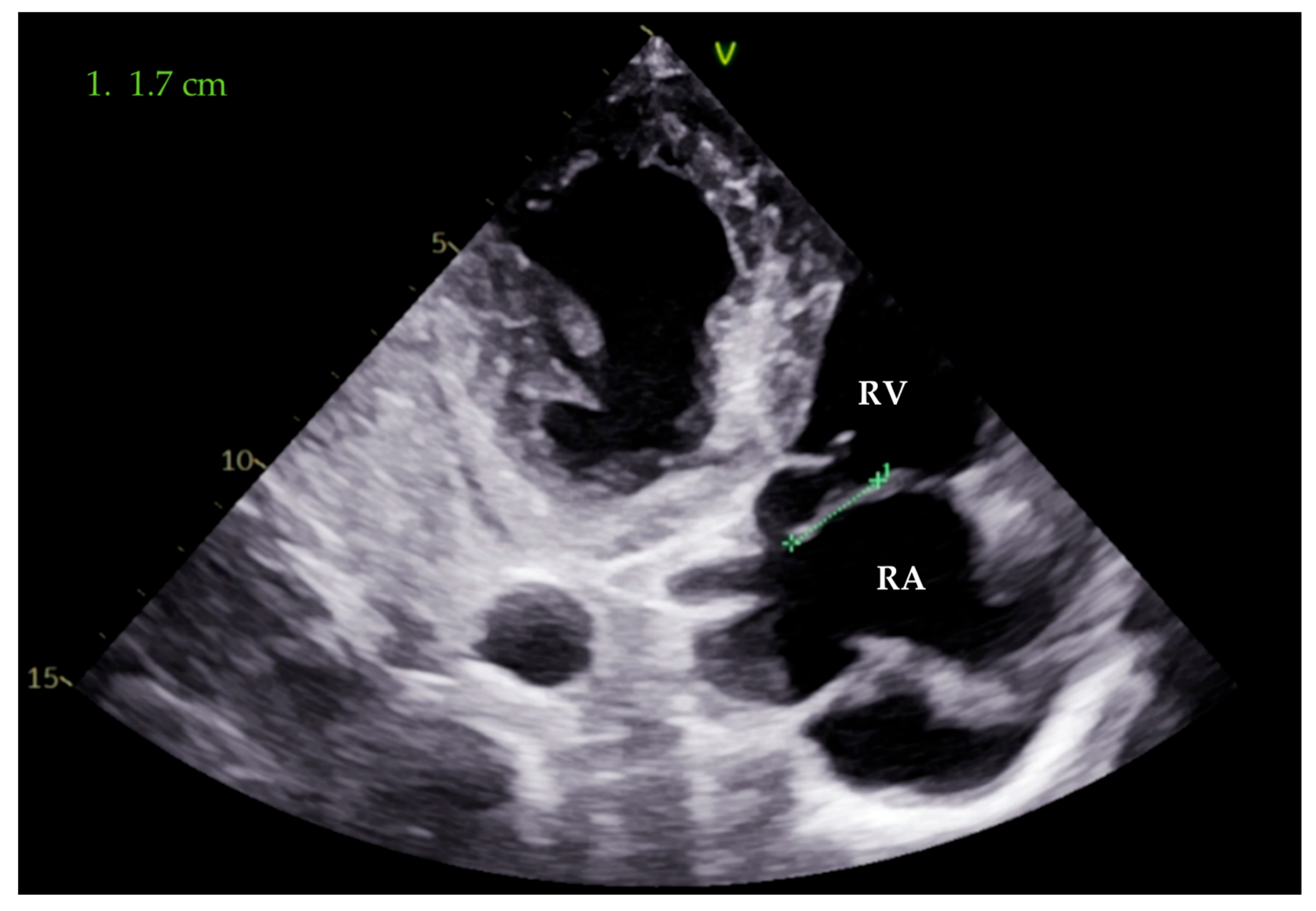 Pathogens 14 00539 g002
