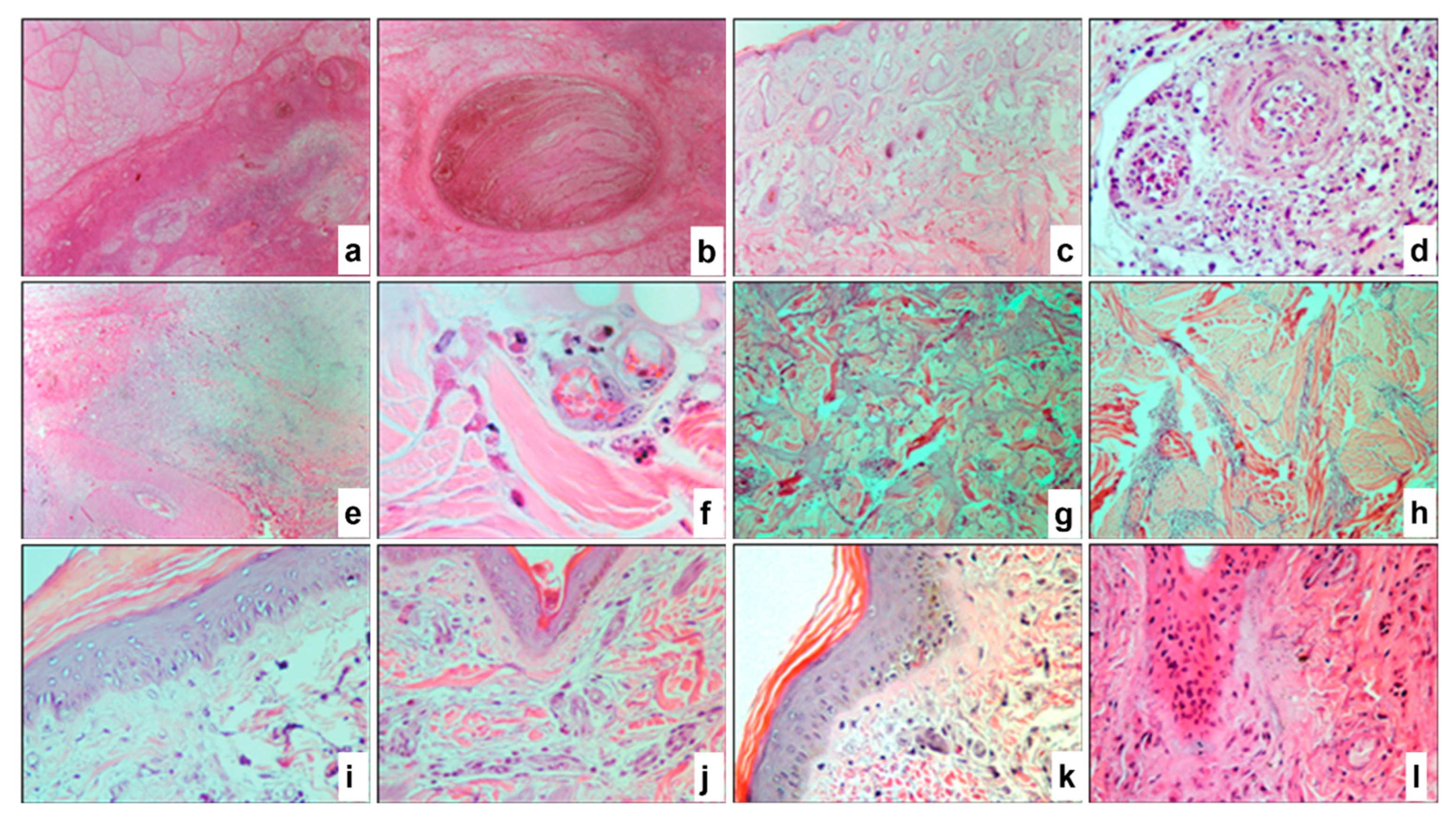 Pathogens 14 00577 g007