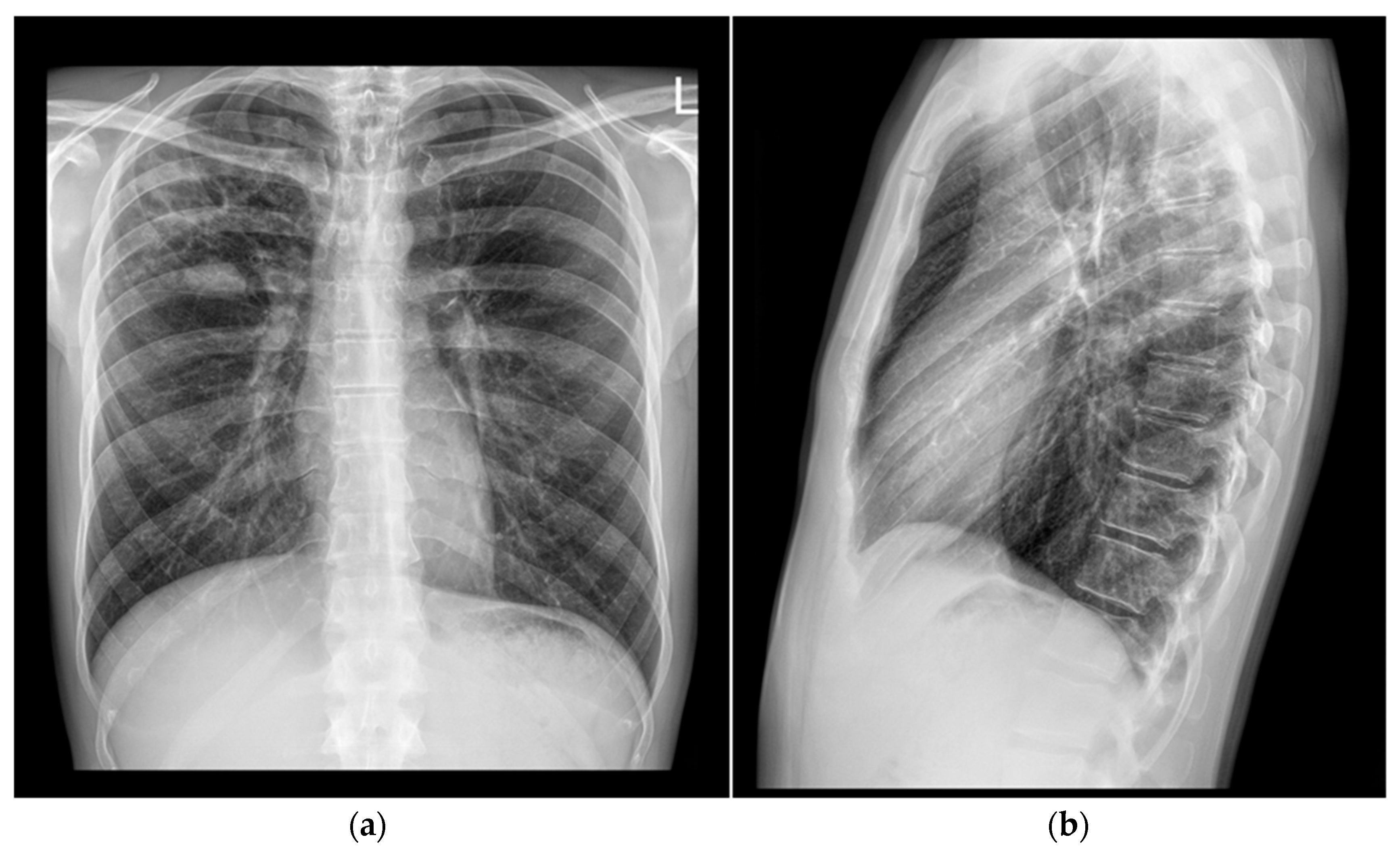 Pathogens 14 00684 g001