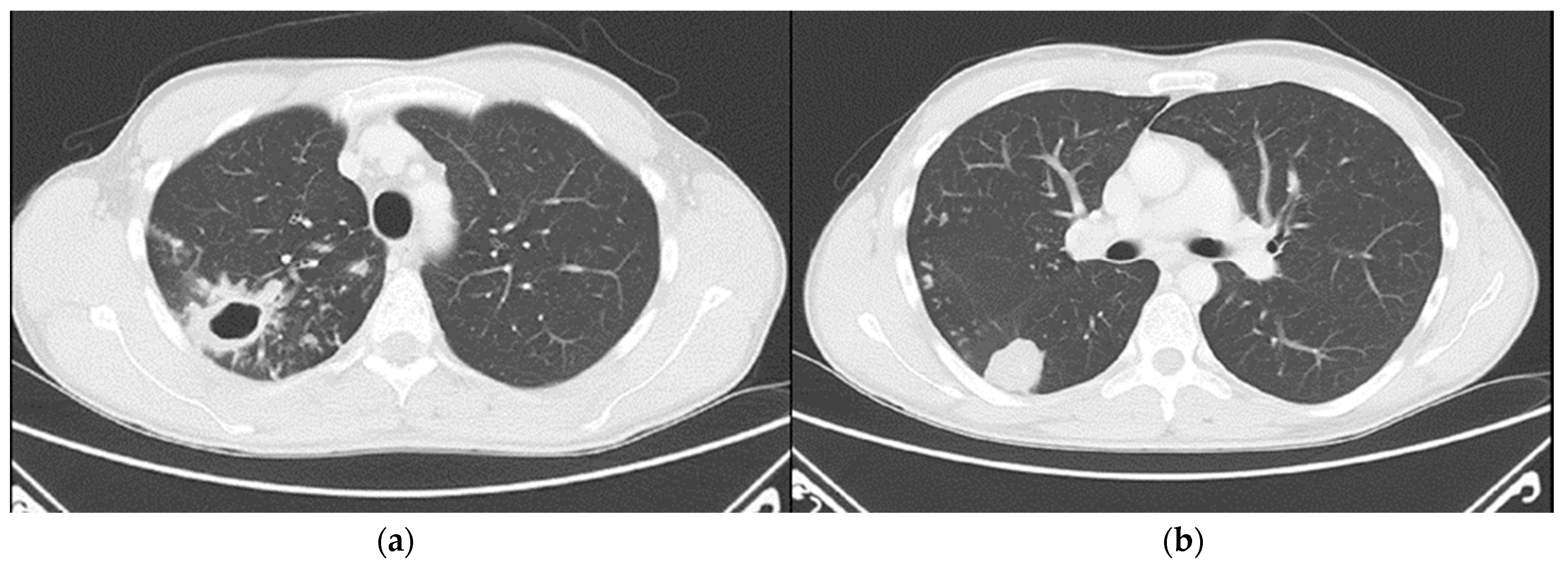 Pathogens 14 00684 g002