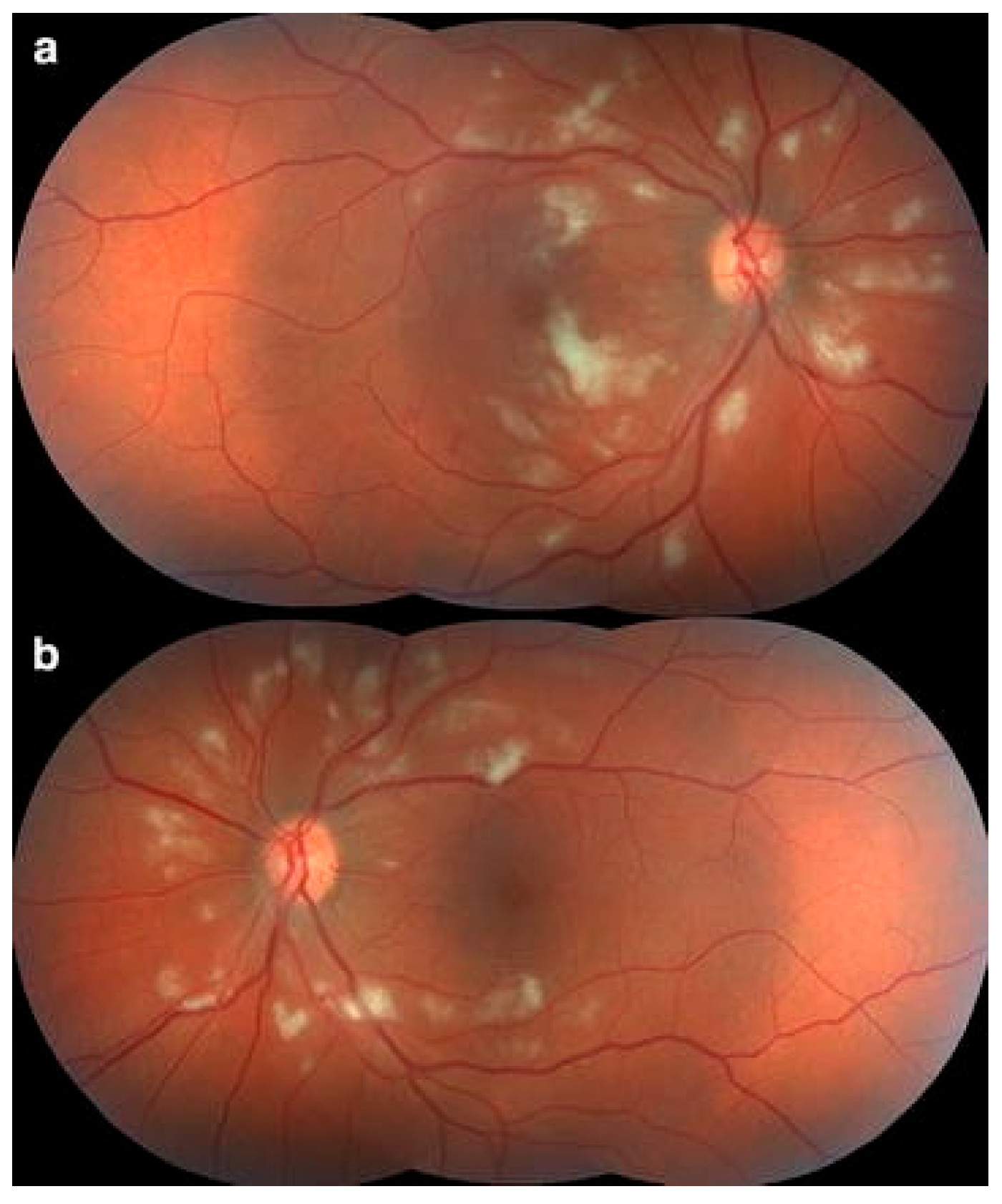 Pathogens 14 00872 g001