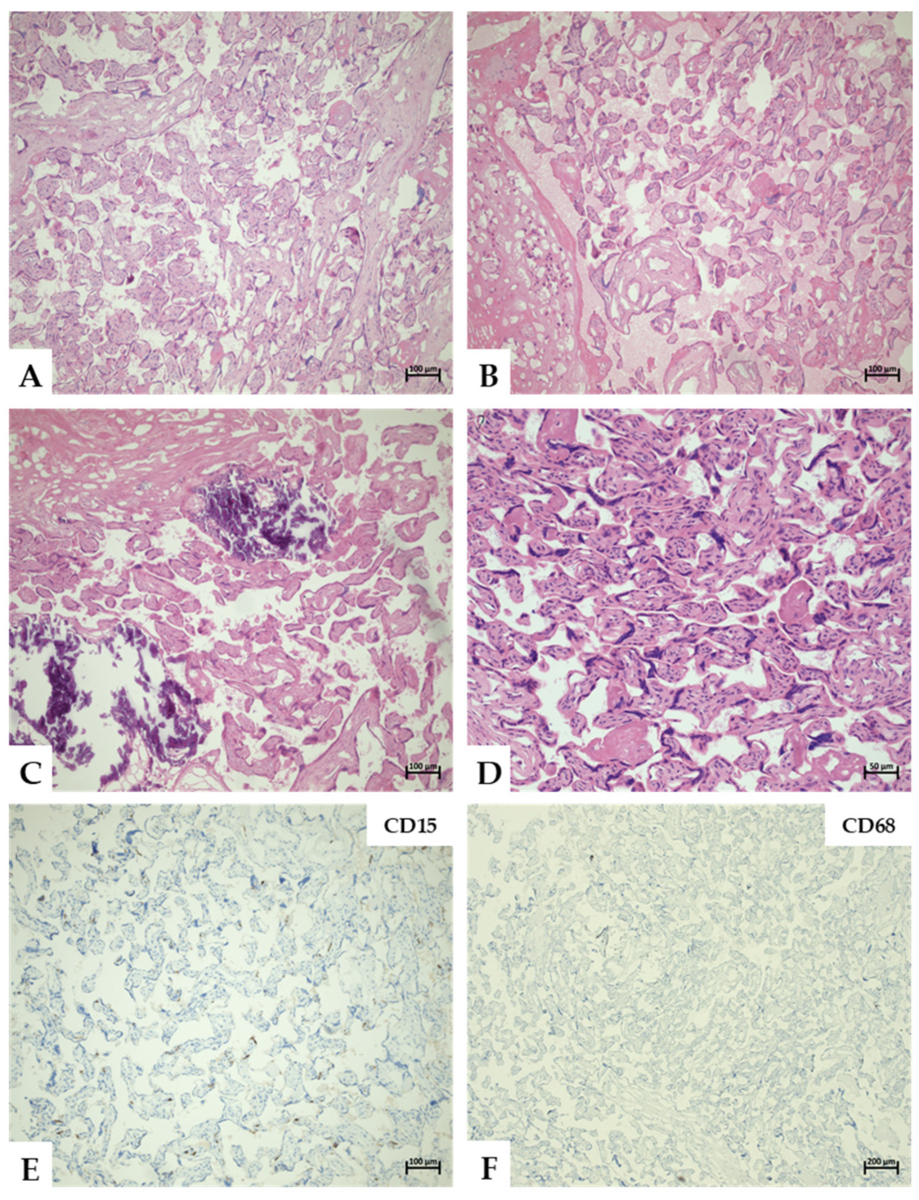 Pathogens 14 01223 g001 Pathogens 14 01223 g001