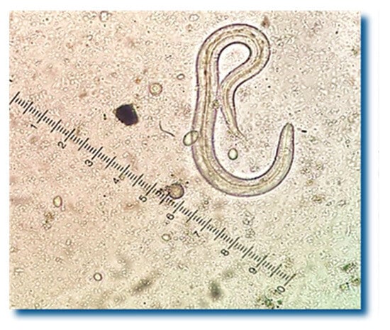 Crenosoma spp. larvae were detected in 87.5% of the hedgehogs’ fecal samples.