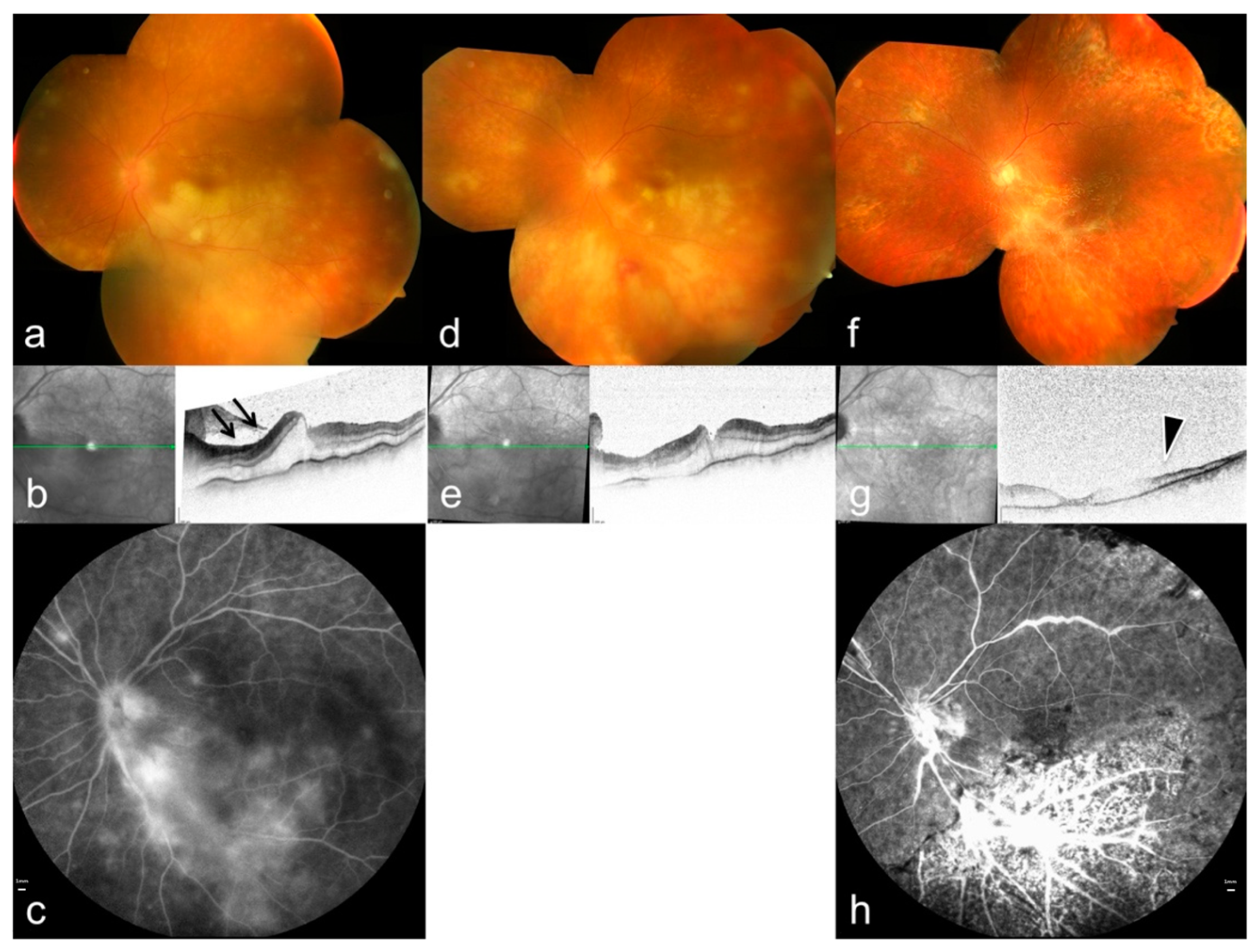 Pathogens 15 00157 g006