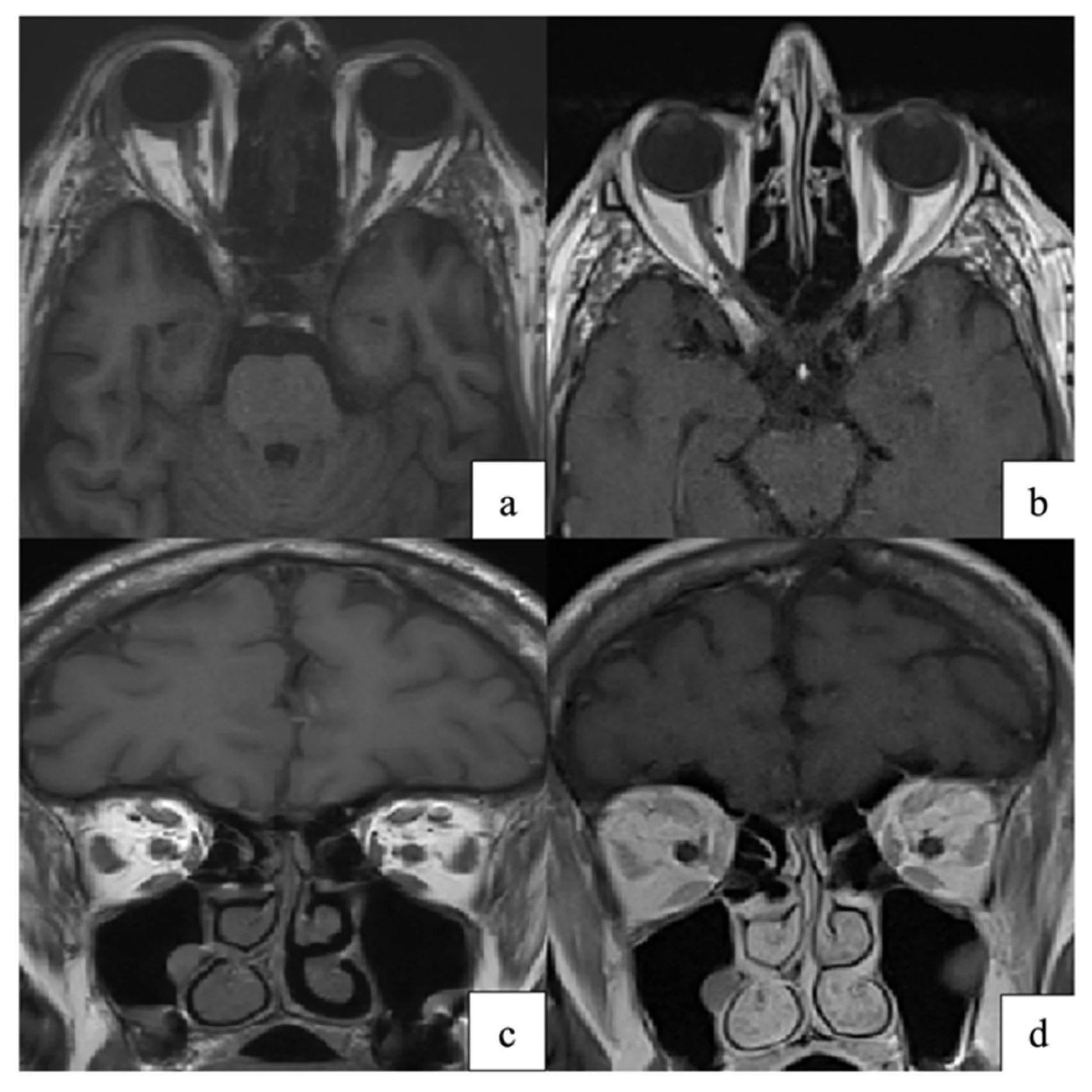 Pathogens 15 00157 g007