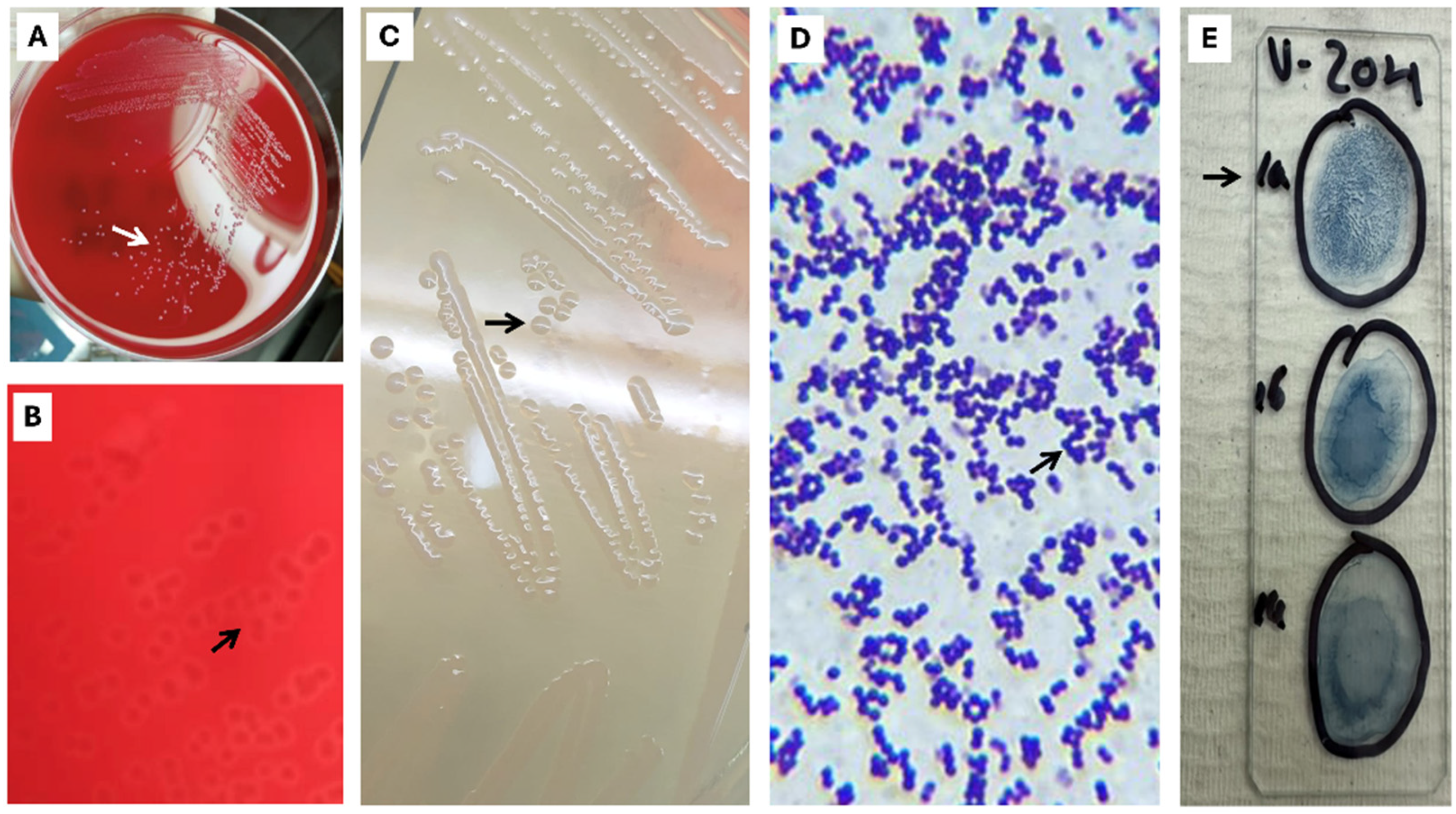 Pathogens 15 00545 g001 Pathogens 15 00545 g001