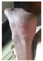 Pathophysiology 27 00003 i003