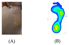 Pathophysiology 27 00003 i005