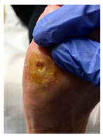 Pathophysiology 27 00003 i007