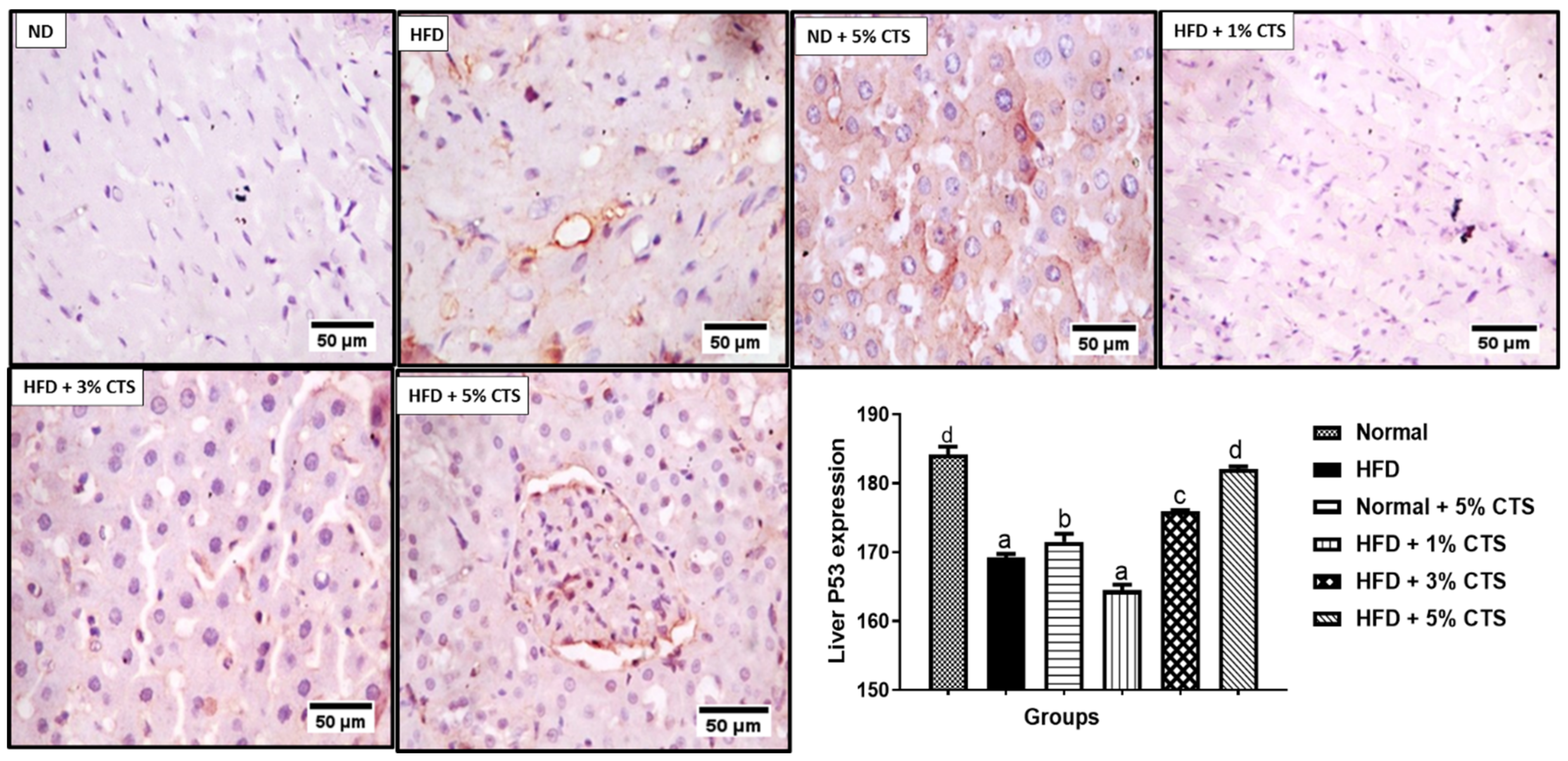 Pathophysiology 28 00015 g004