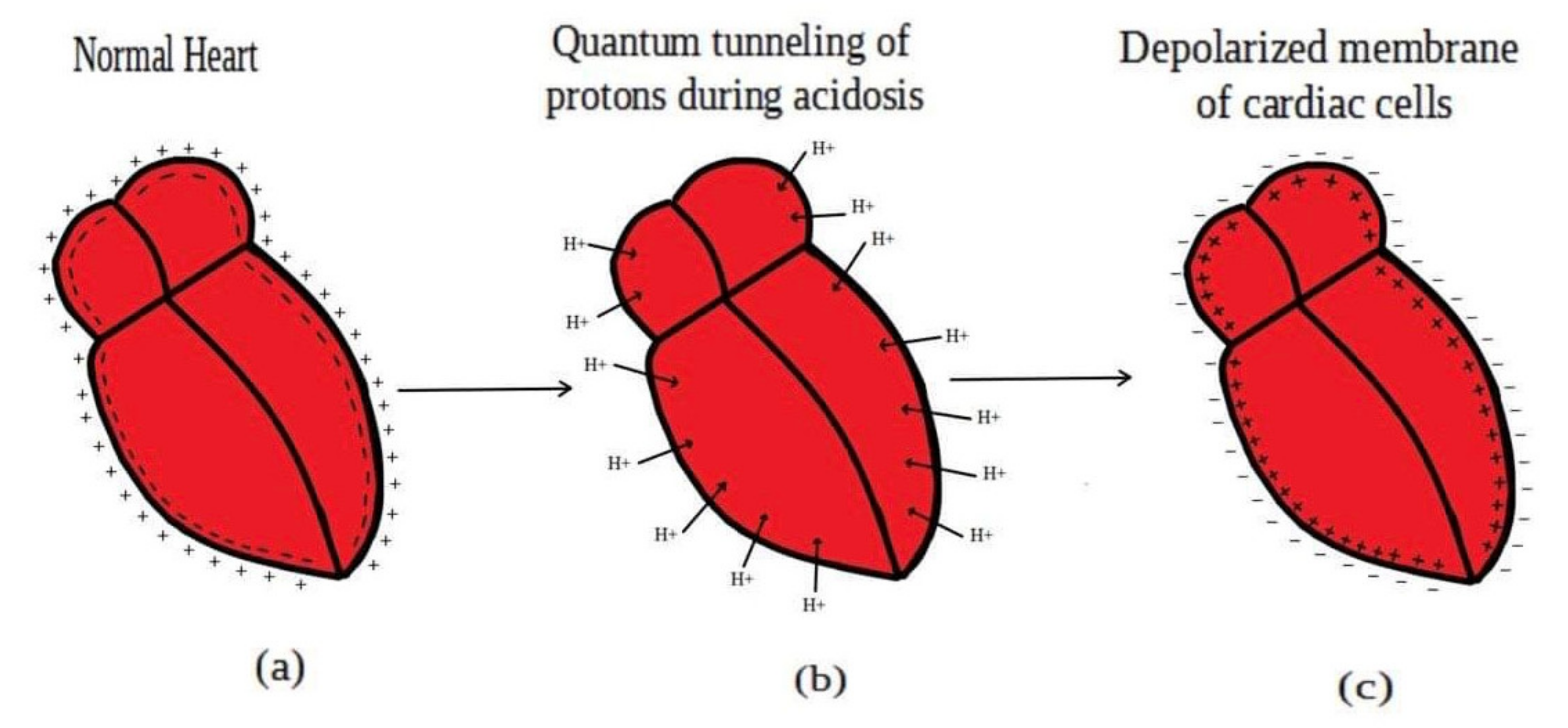 Pathophysiology 28 00027 g014