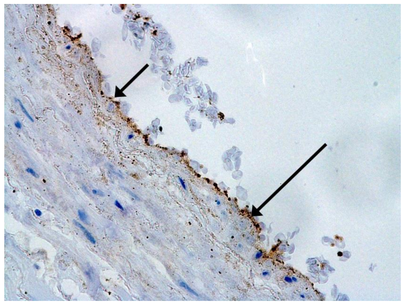 Pathophysiology 29 00021 g001