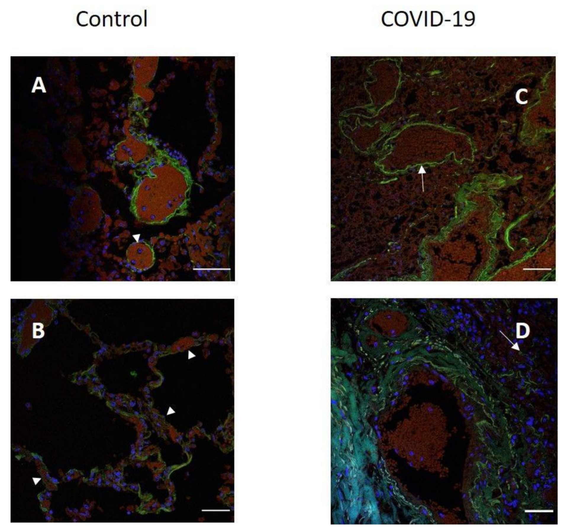 Pathophysiology 29 00021 g003