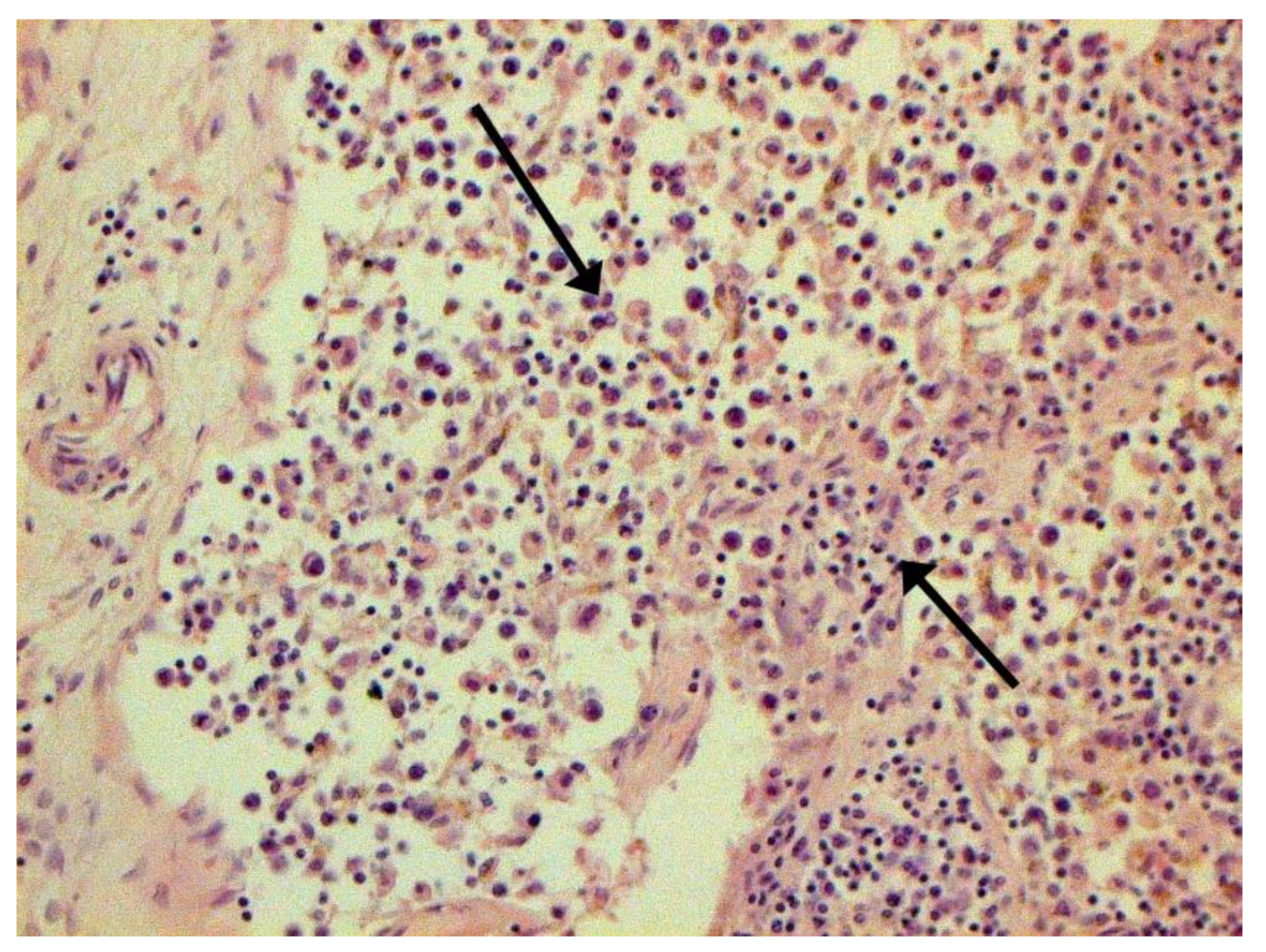 Pathophysiology 29 00021 g005