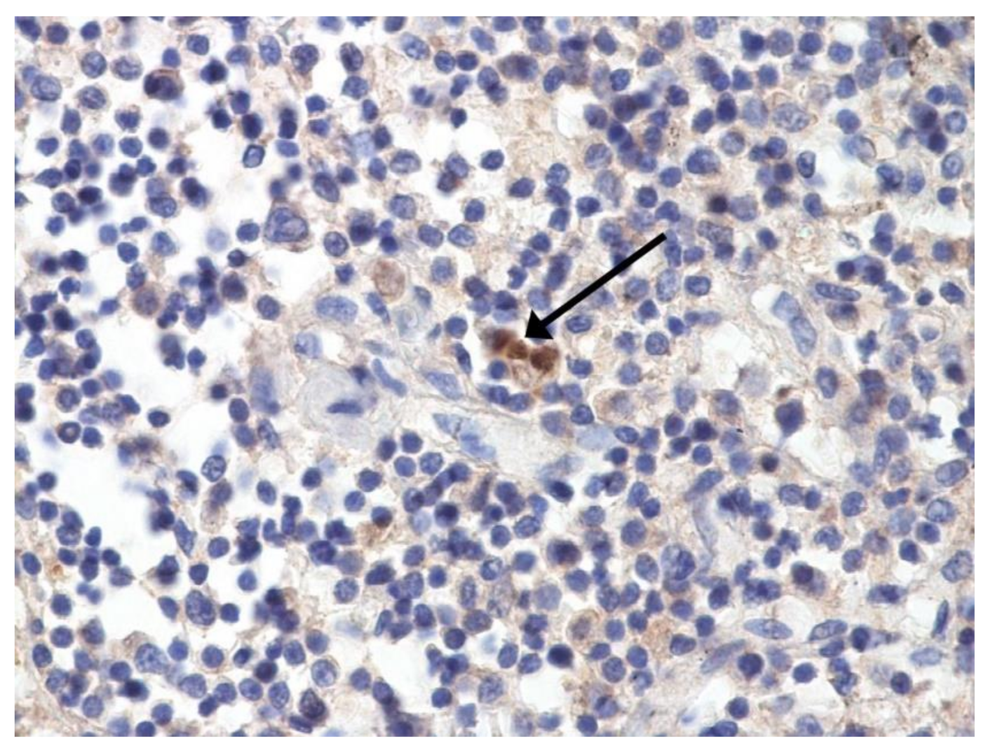 Pathophysiology 29 00021 g006