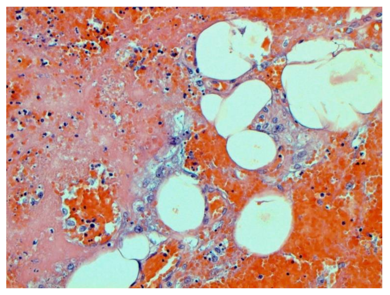 Pathophysiology 29 00021 g008