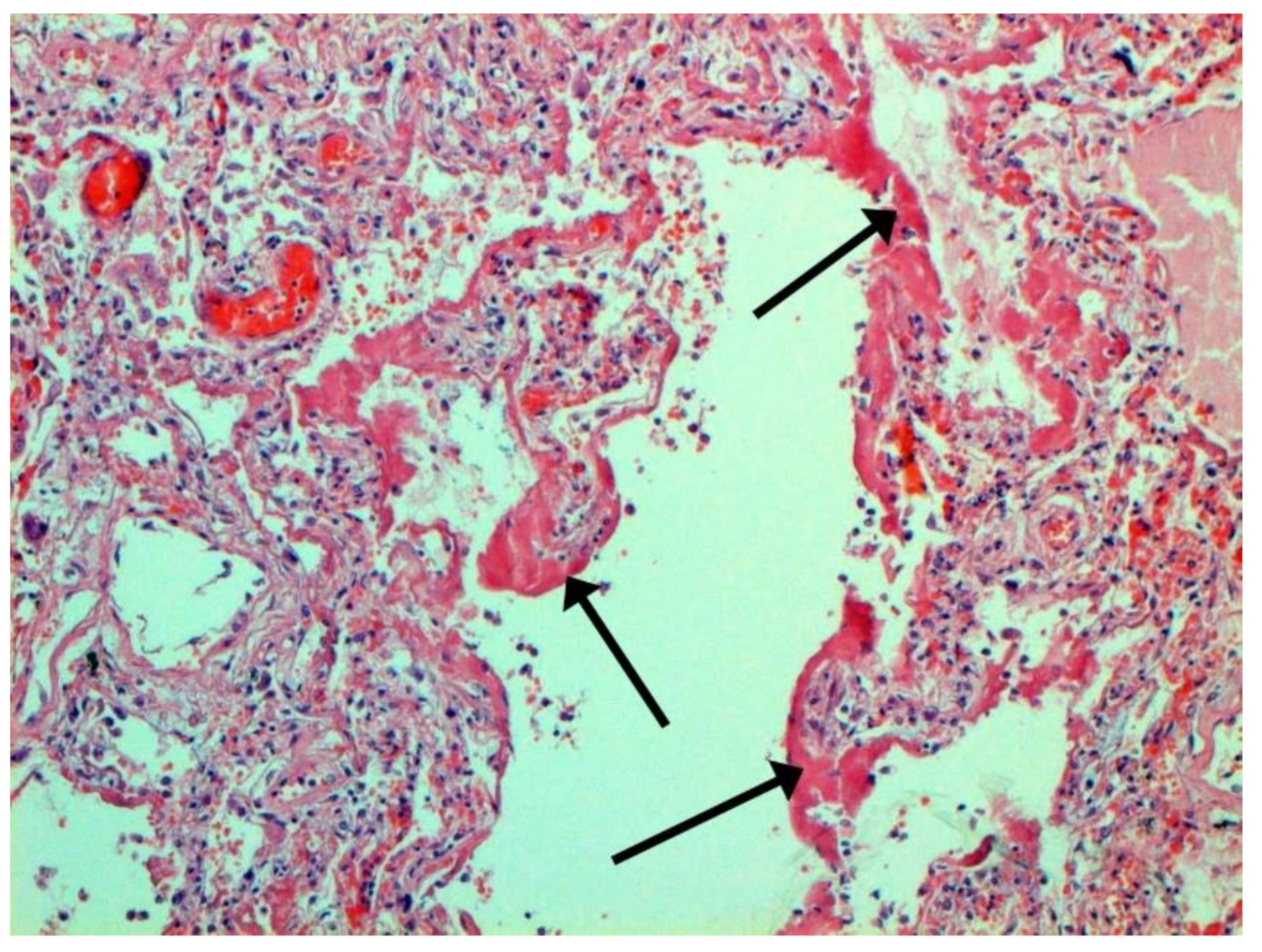 Pathophysiology 29 00021 g009