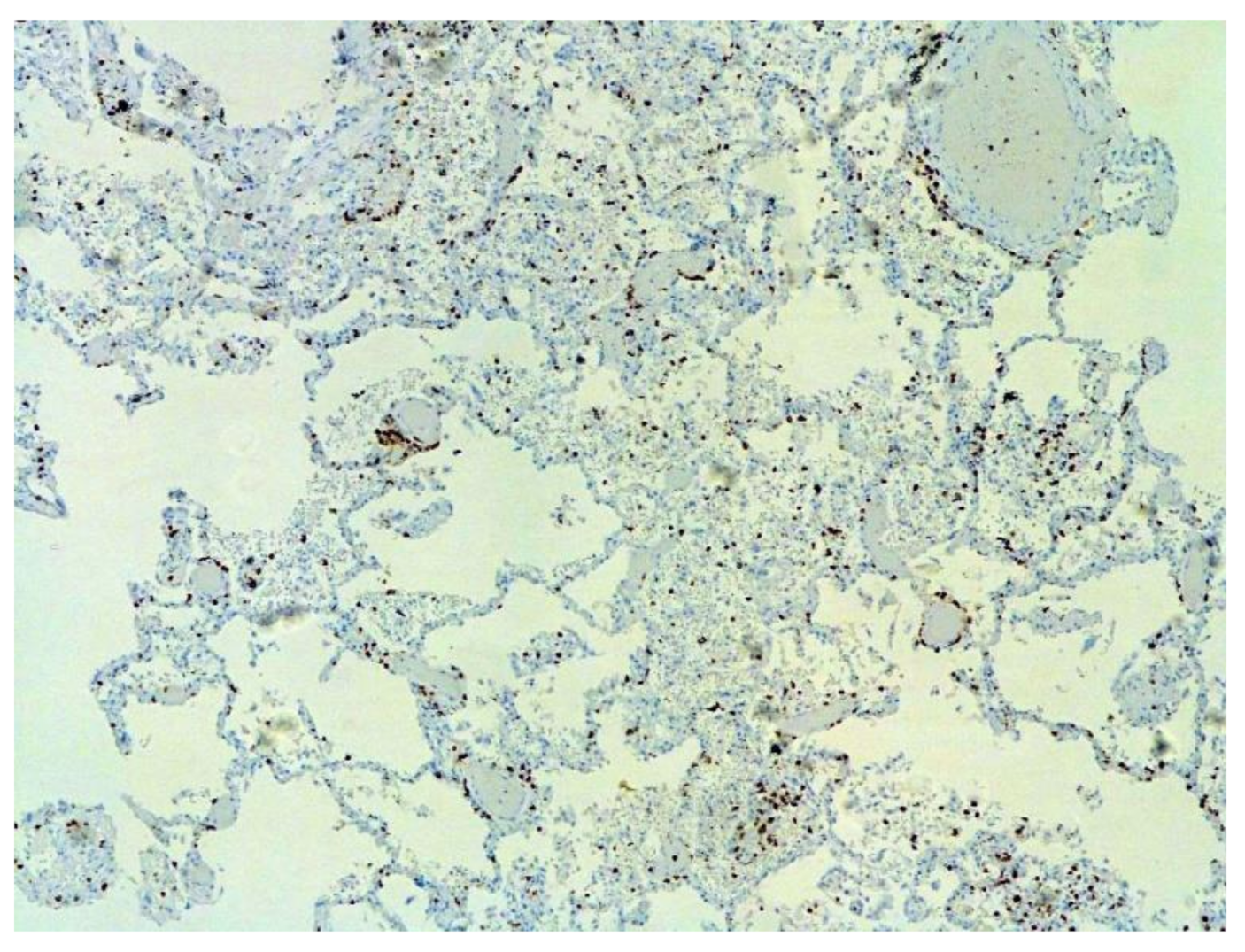 Pathophysiology 29 00021 g010