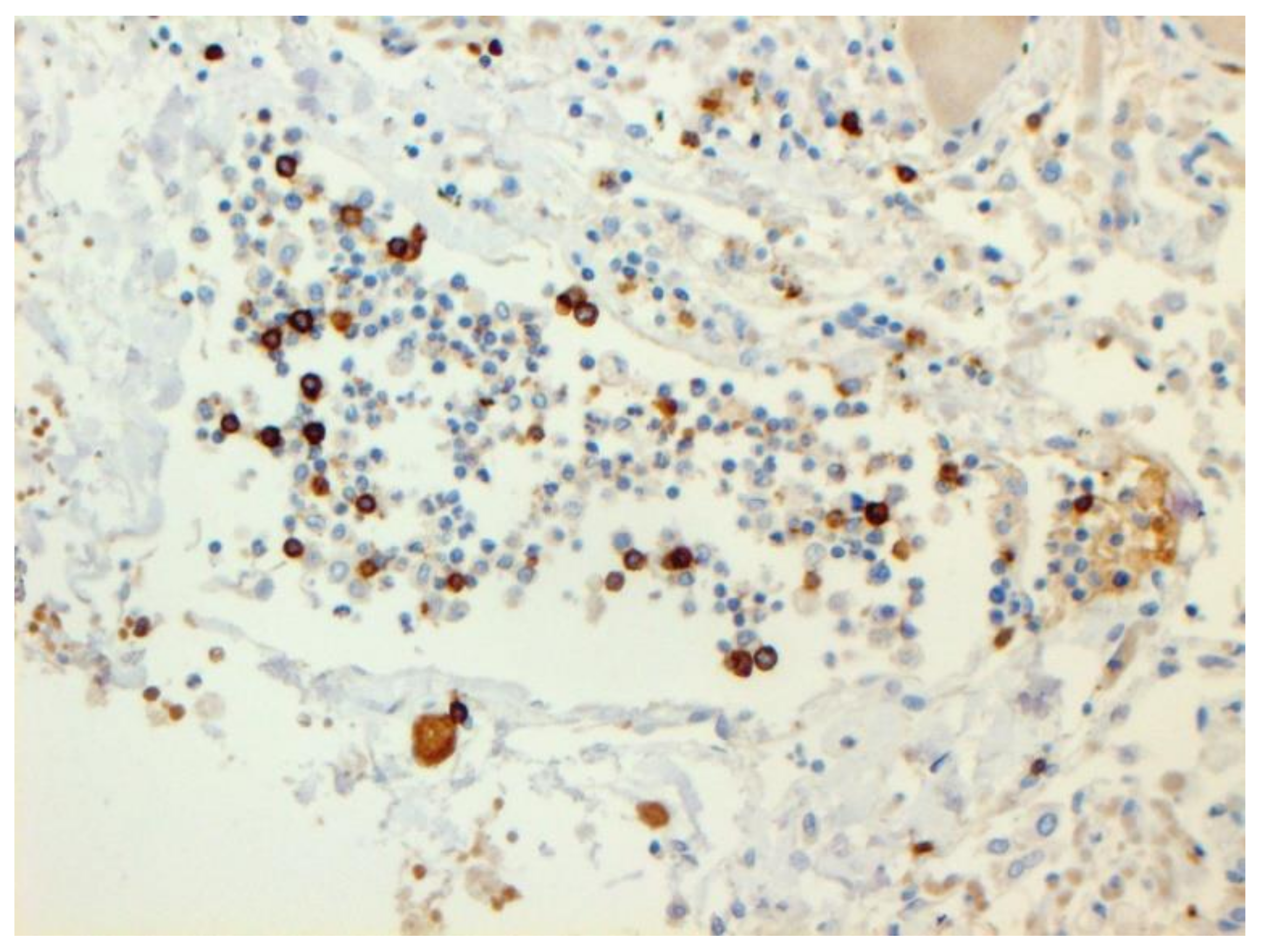 Pathophysiology 29 00021 g011