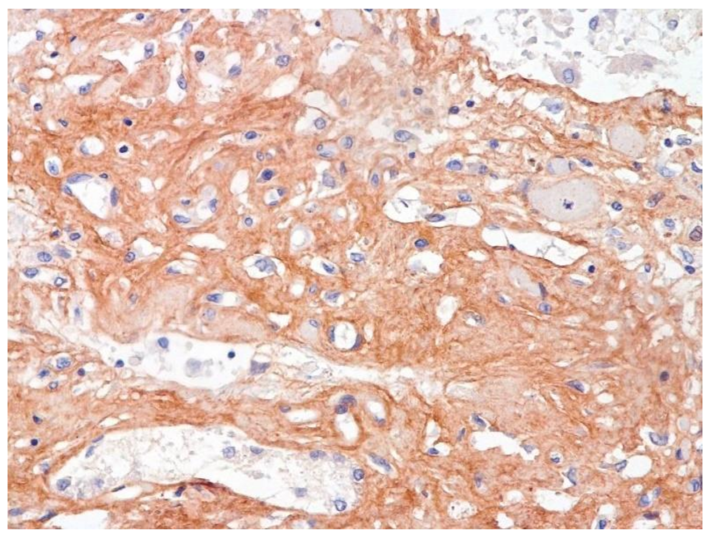 Pathophysiology 29 00021 g013