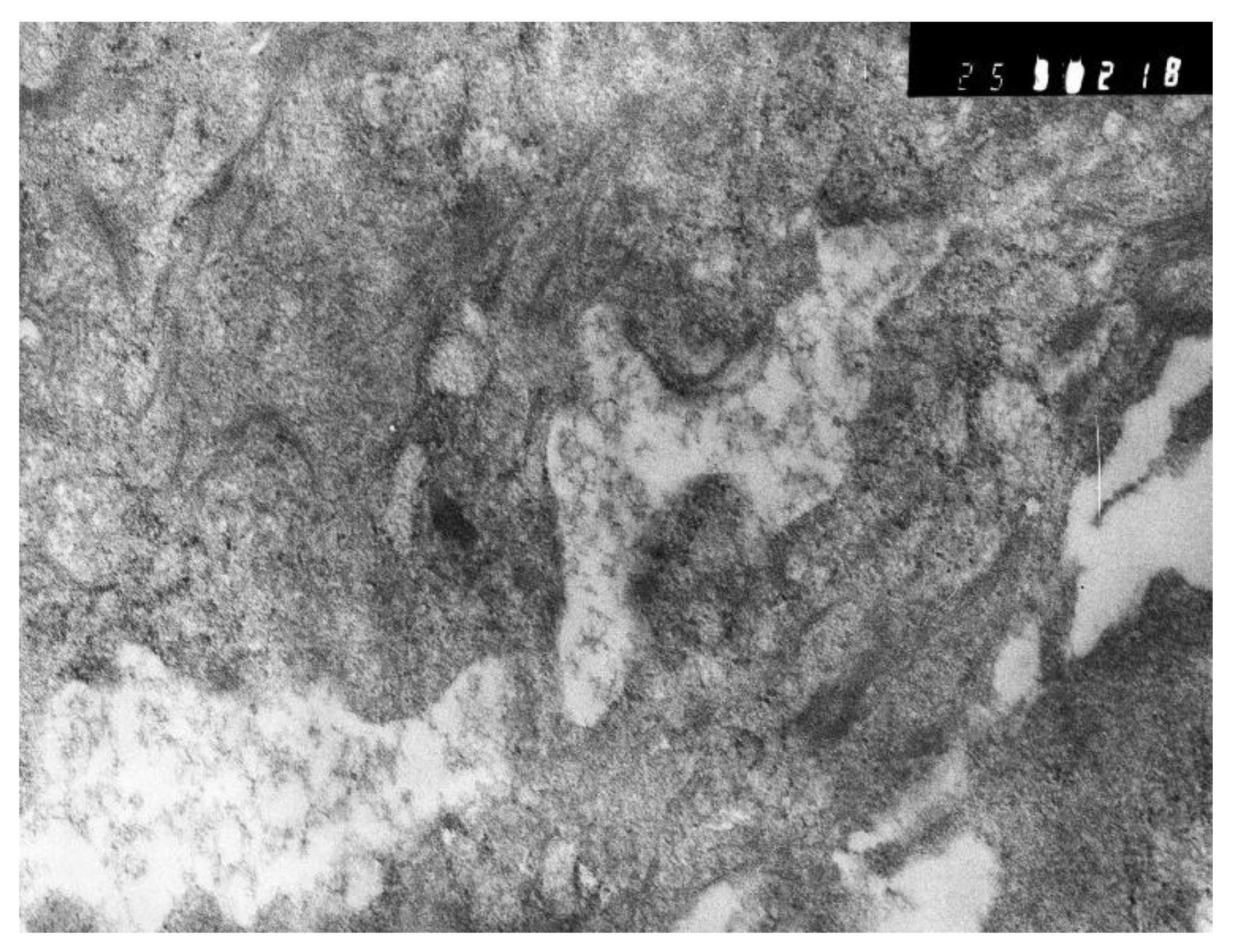 Pathophysiology 29 00021 g015