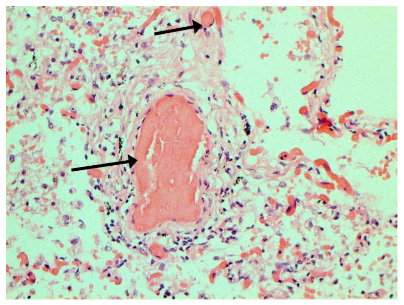 Pathophysiology 29 00021 g016