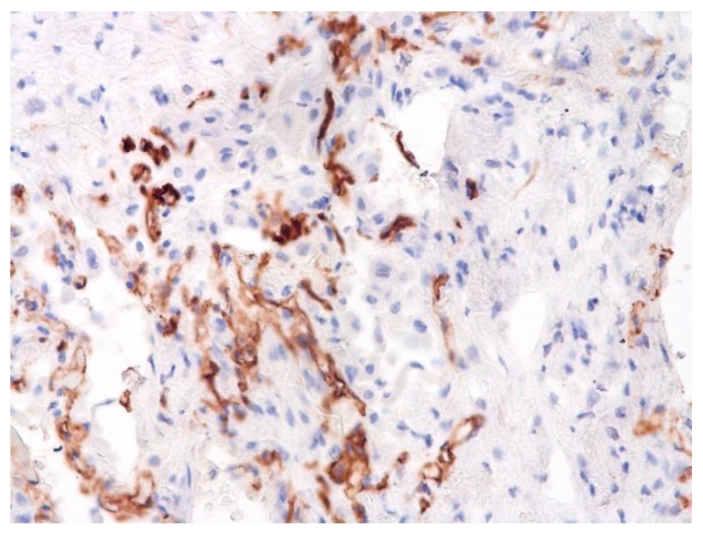 Pathophysiology 29 00021 g017