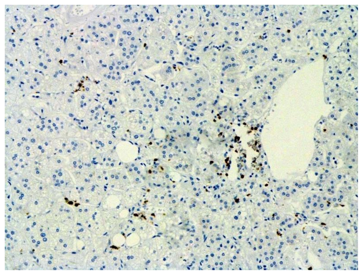 Pathophysiology 29 00021 g018