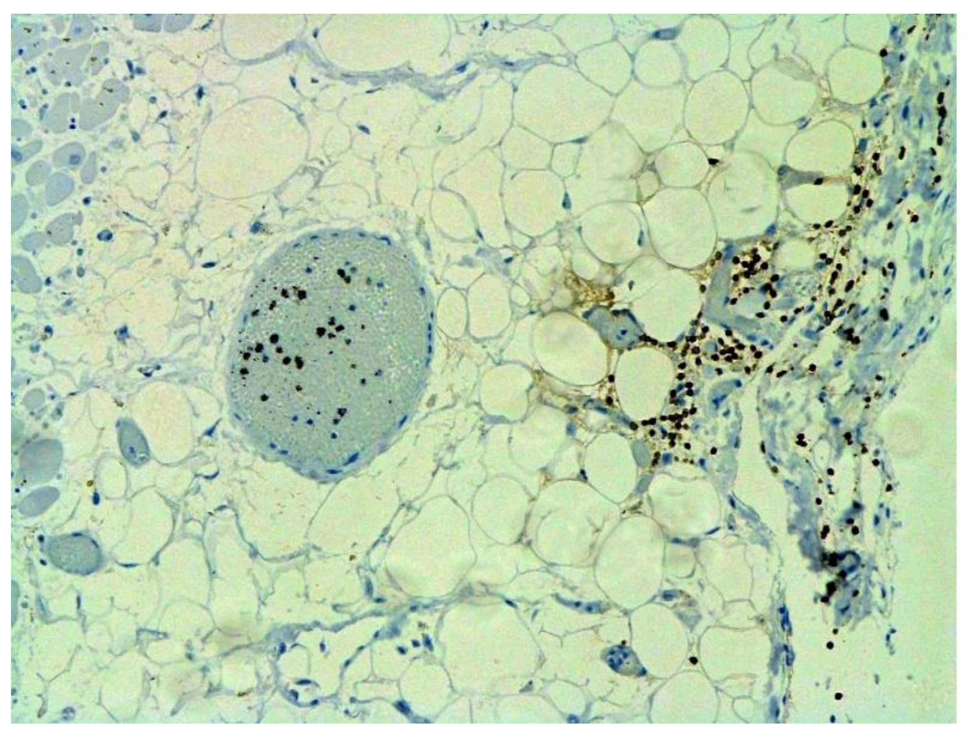 Pathophysiology 29 00021 g019