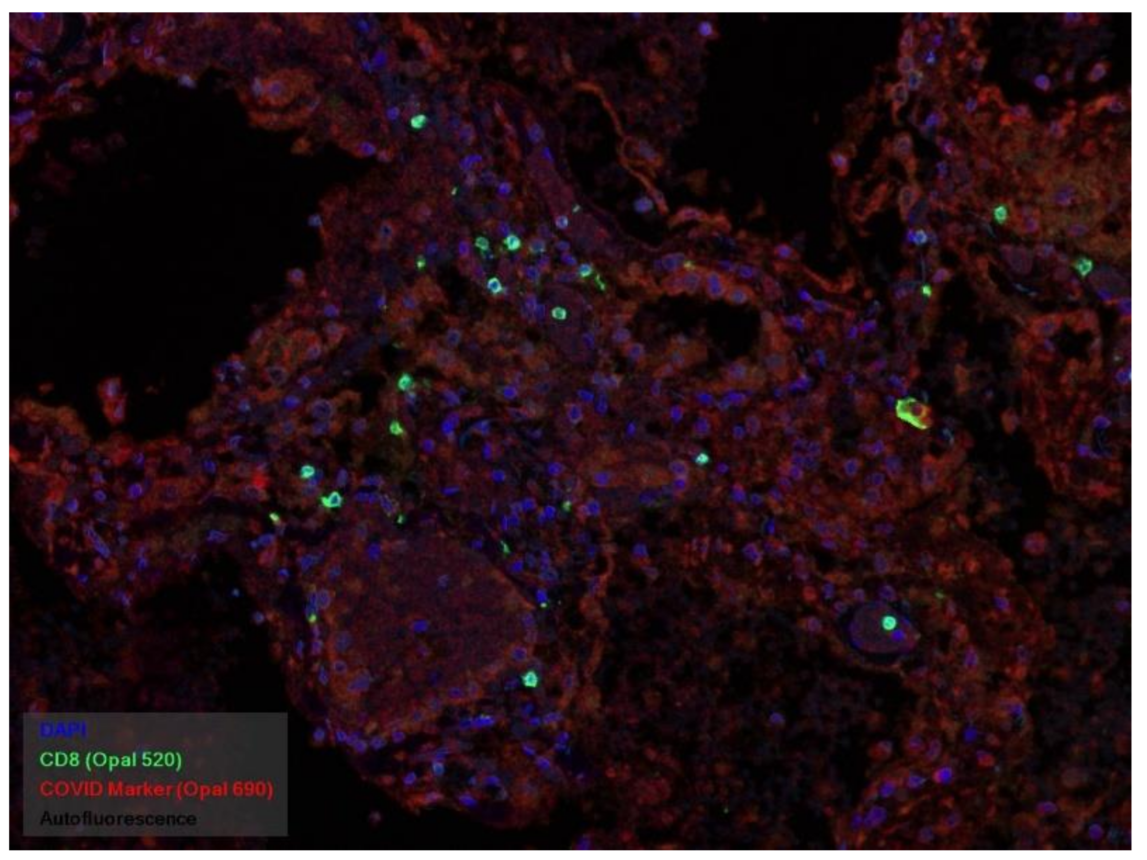 Pathophysiology 29 00021 g020