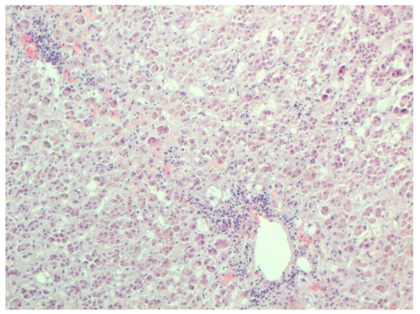 Pathophysiology 29 00021 g021