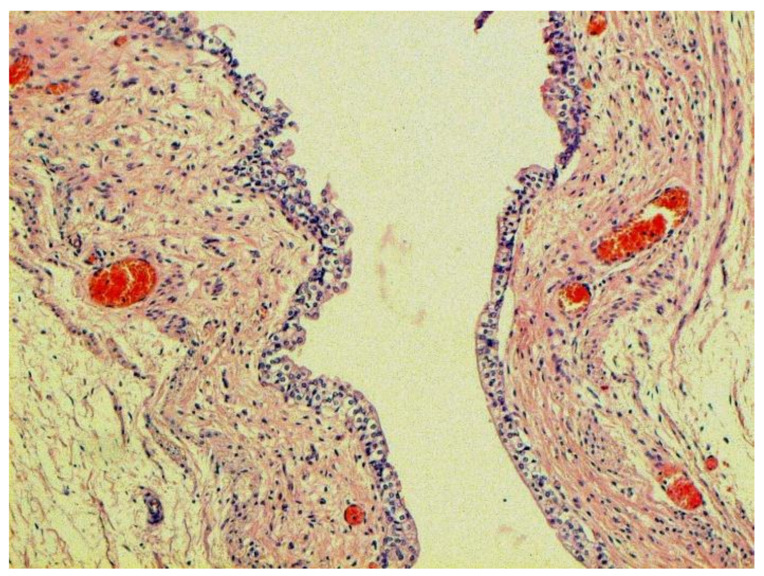 Pathophysiology 29 00021 g022