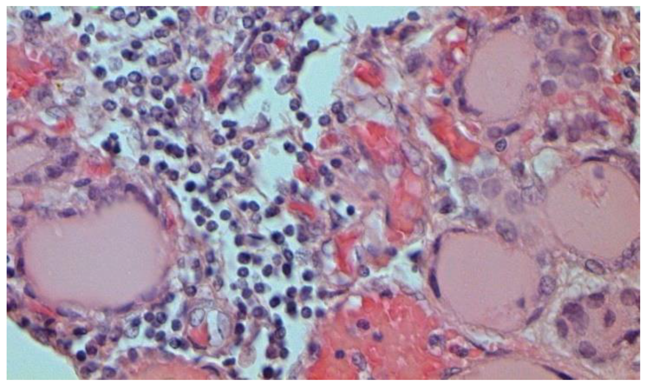 Pathophysiology 29 00021 g025