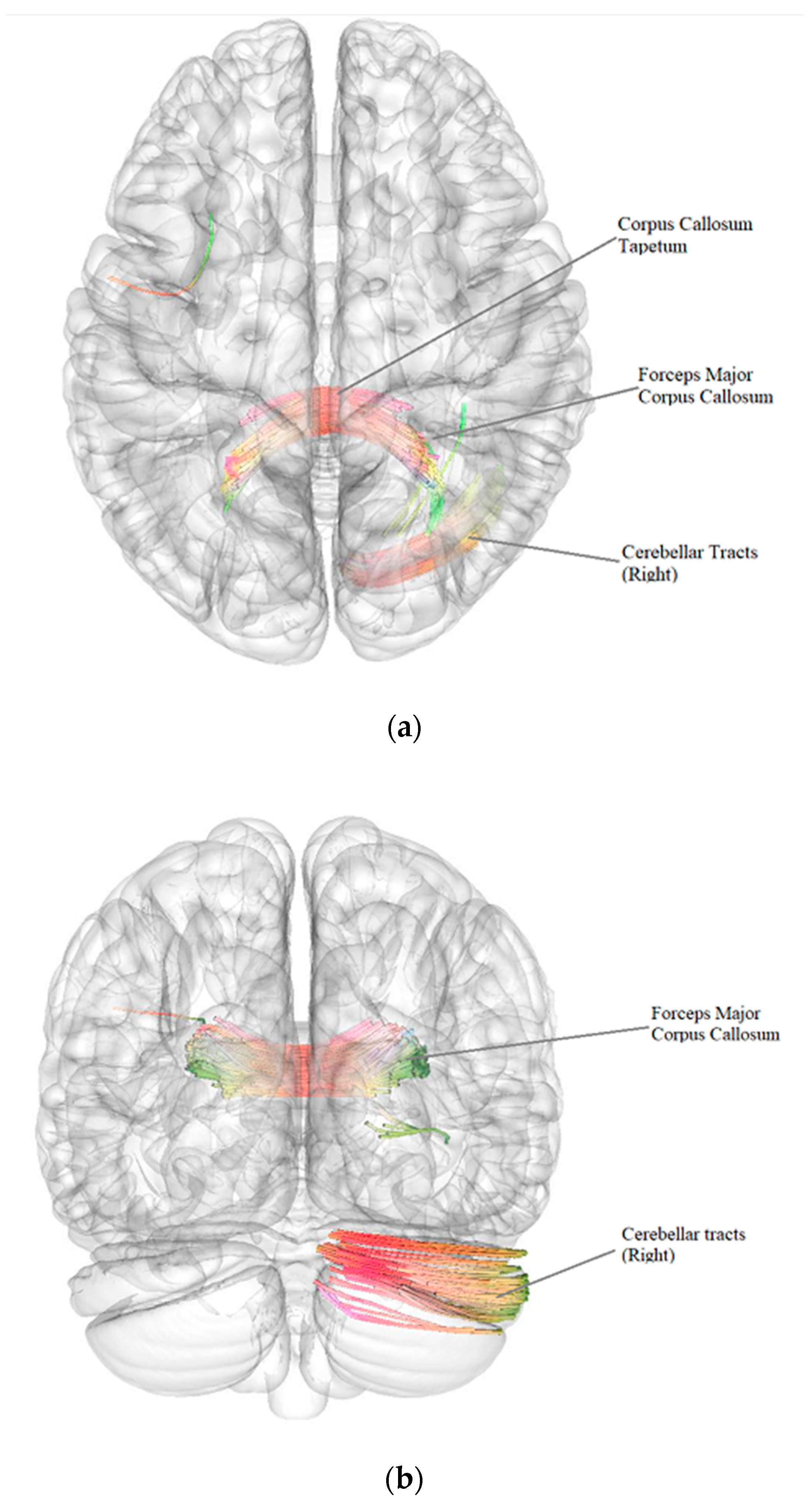 Pathophysiology 29 00046 g003 Pathophysiology 29 00046 g003