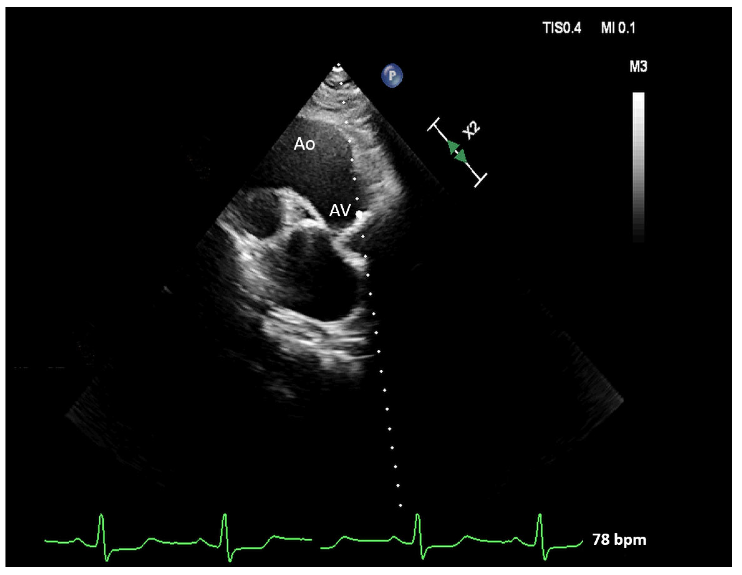 Pathophysiology 30 00015 g004
