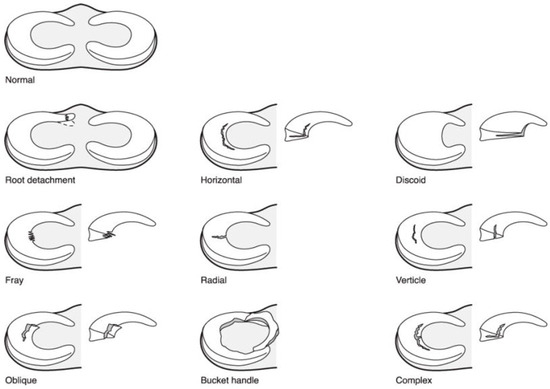 Pathophysiology 30 00044 g003