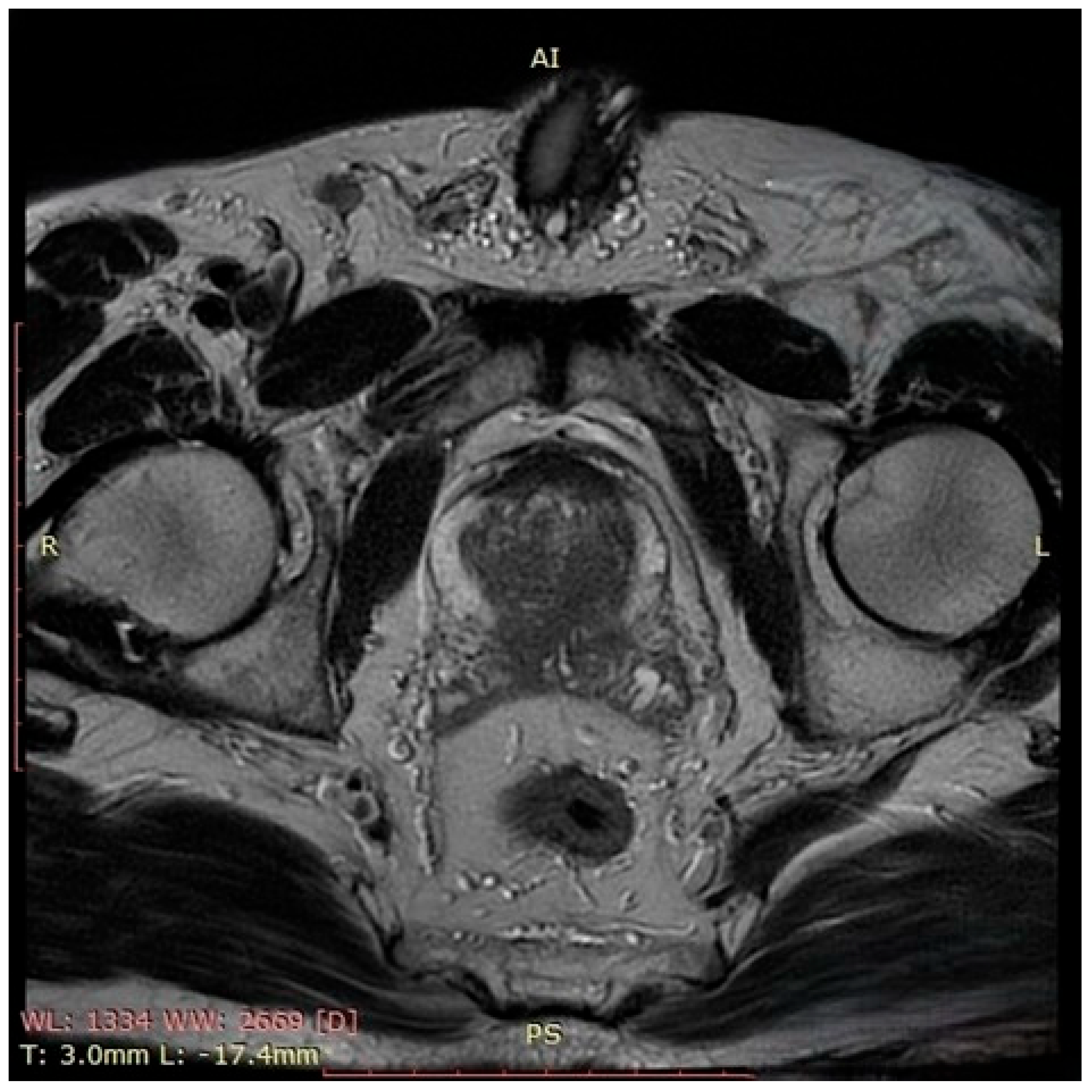 Pathophysiology 32 00038 g001 Pathophysiology 32 00038 g001