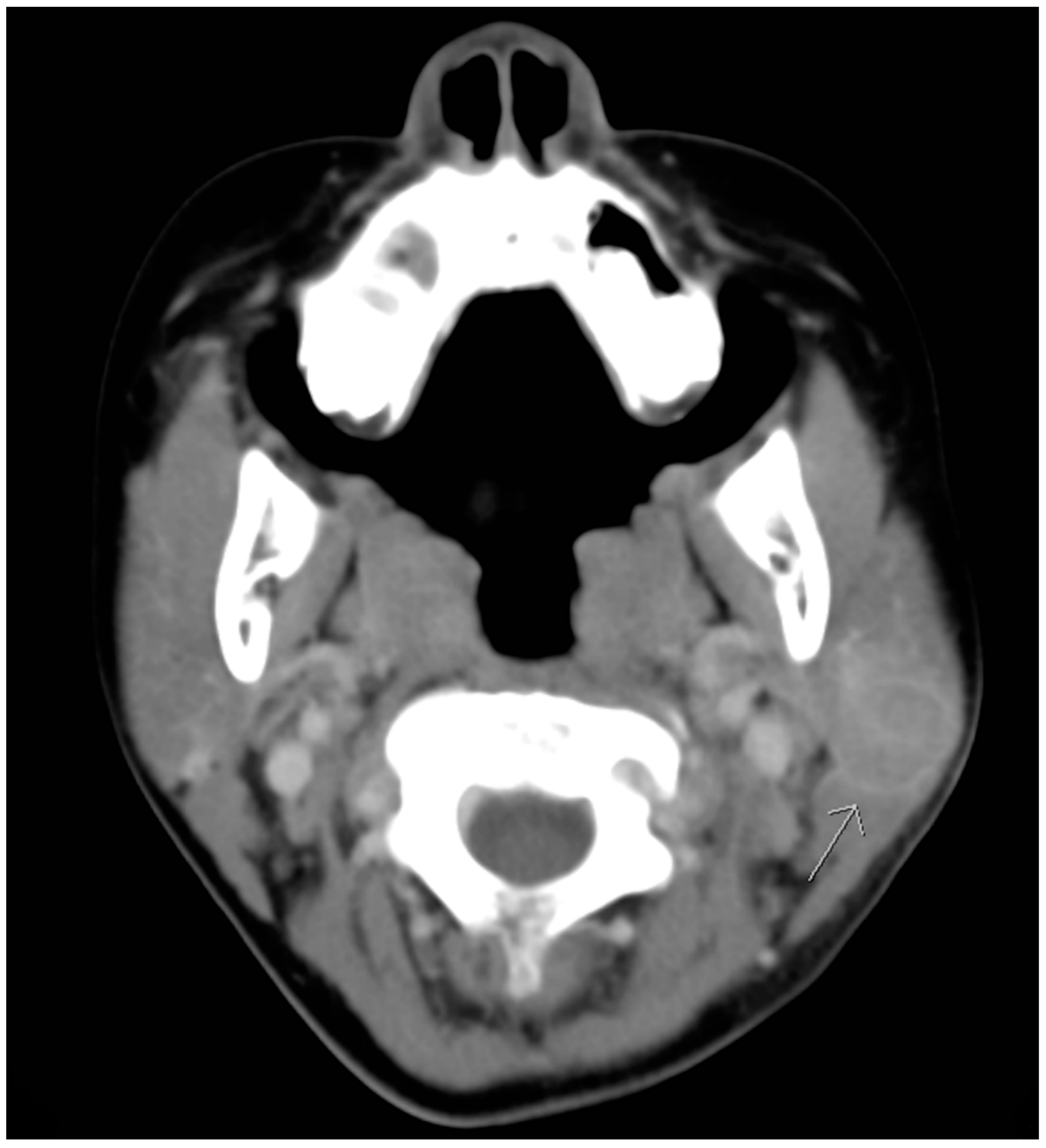 Pediatrrep 12 00022 g003