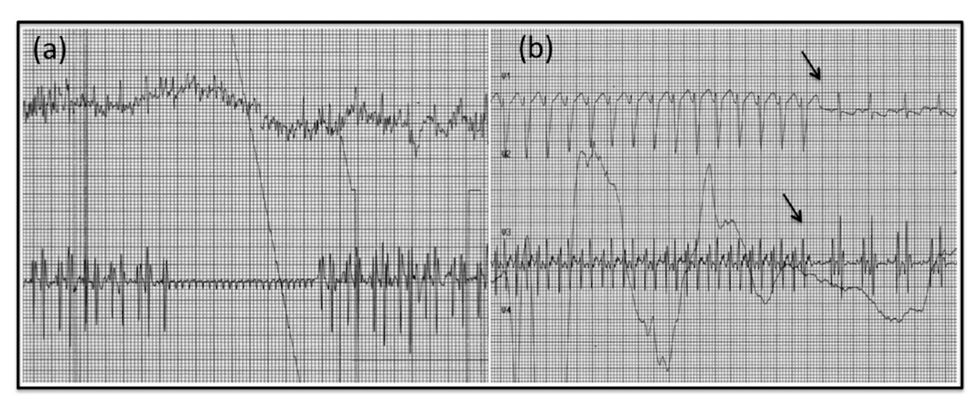 Pediatrrep 12 00024 g003
