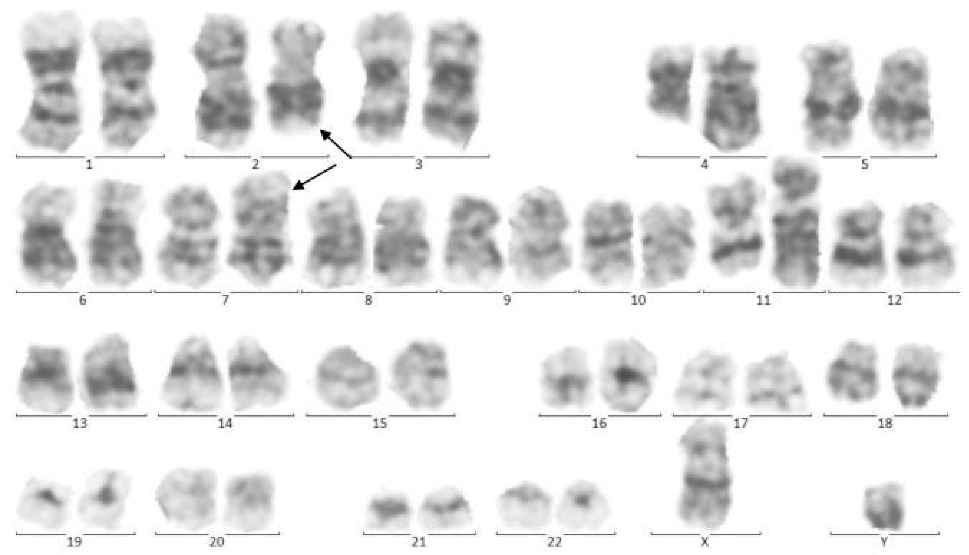 Pediatrrep 13 00002 g002 Pediatrrep 13 00002 g002