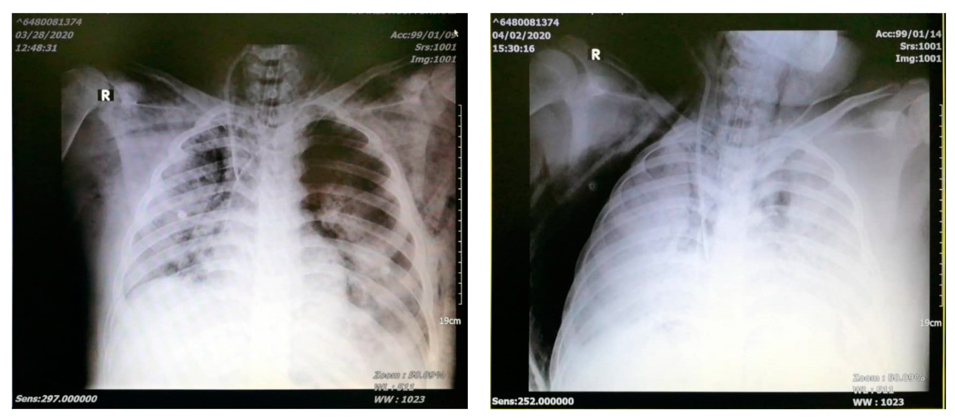 Pediatrrep 13 00004 g001